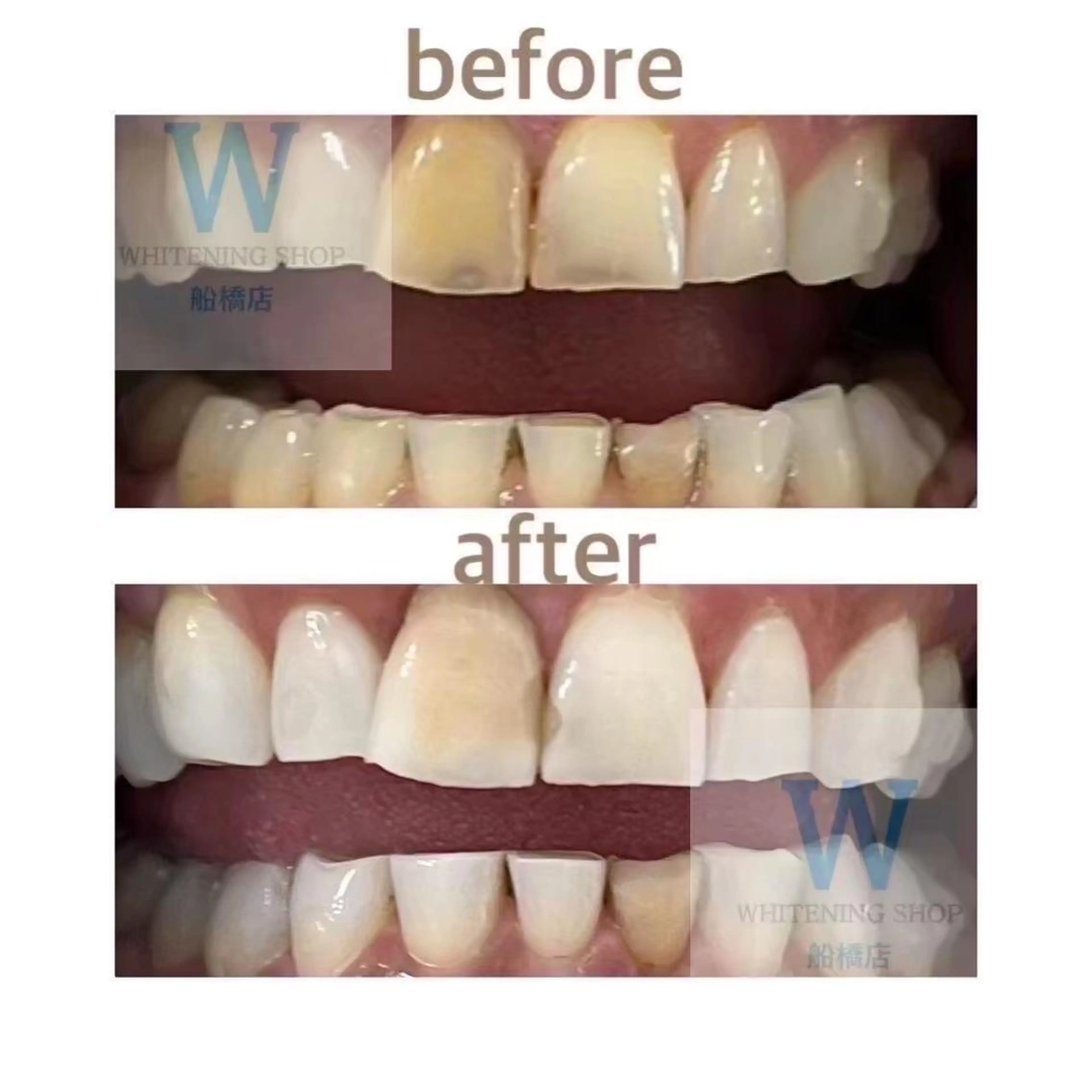 ホワイトニング ショップ船橋店🦷のエステ・リラクイメージ