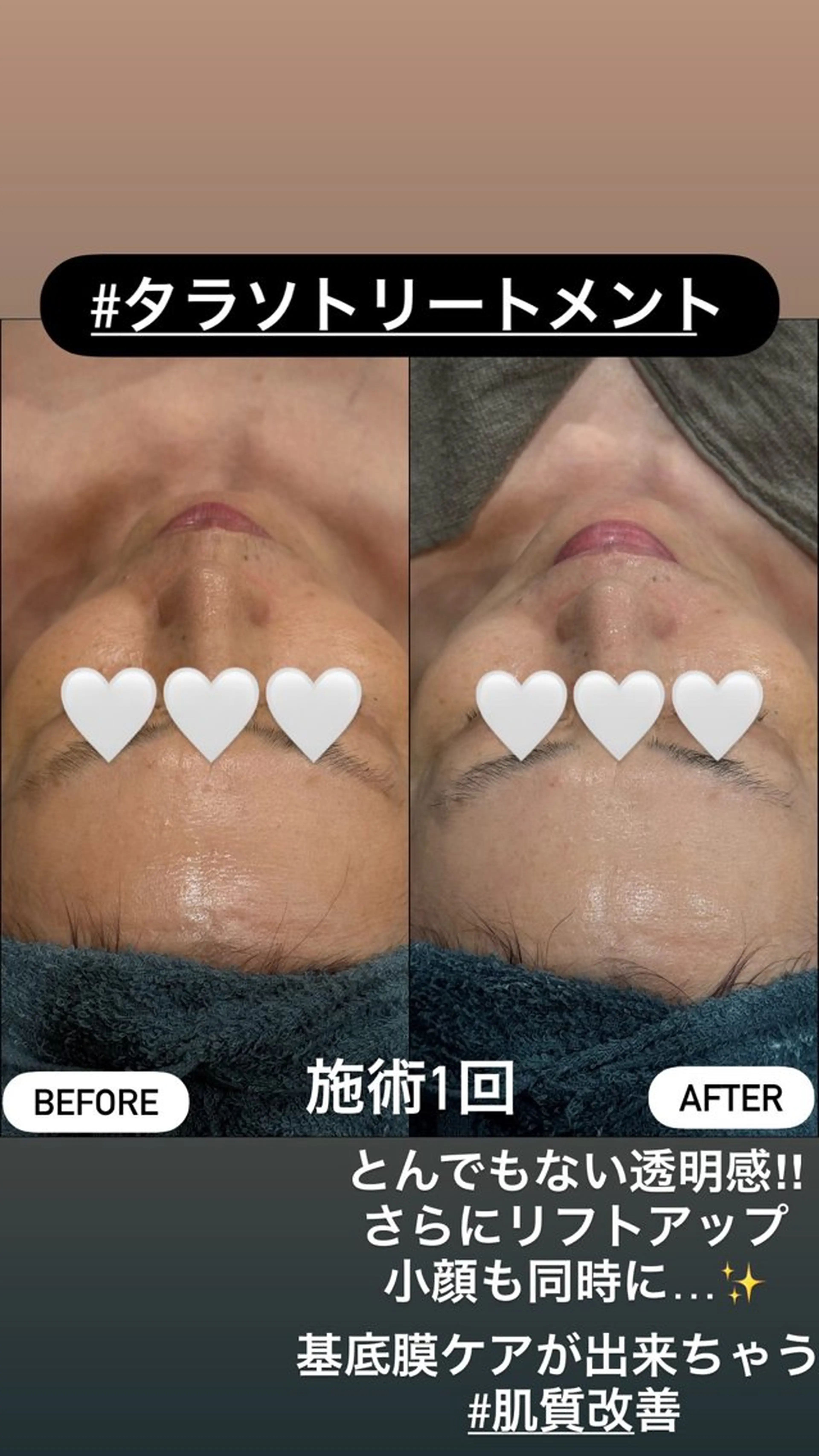 エステ LiZA エステティックサロンのエステ・リラクイメージ