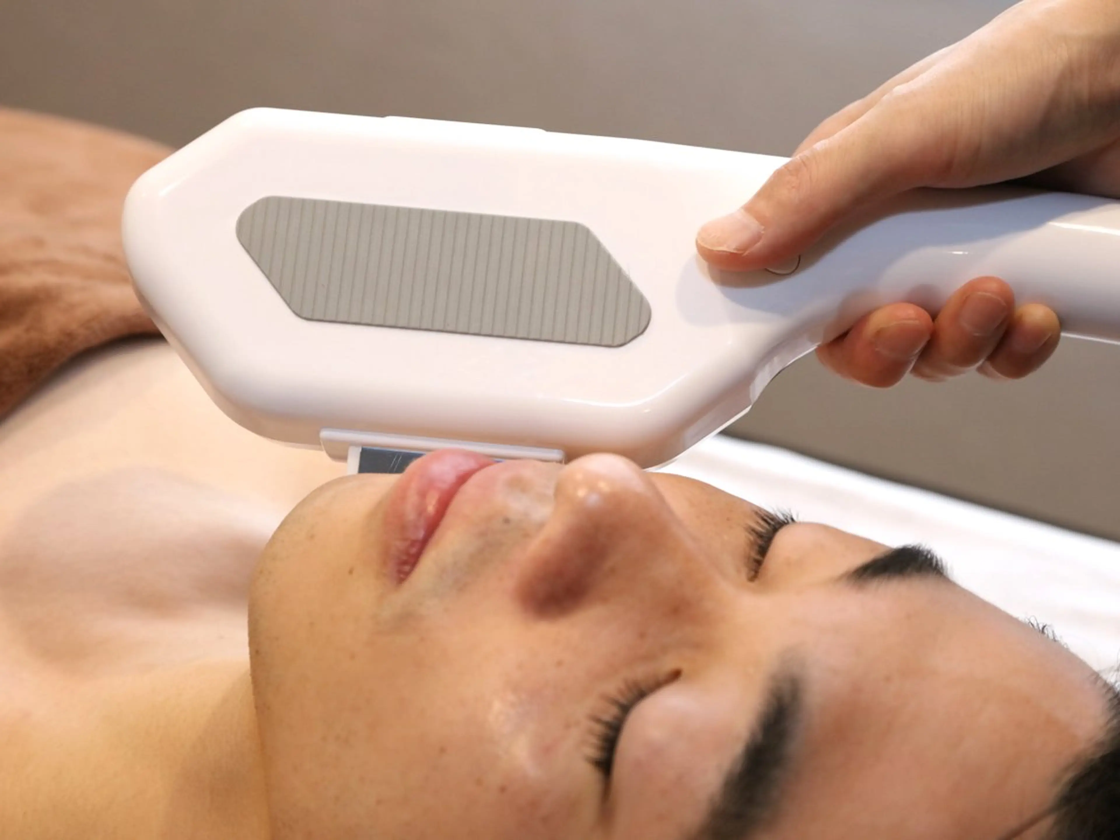 【お試し】顔脱毛 (首から上全パーツ込み)の写真