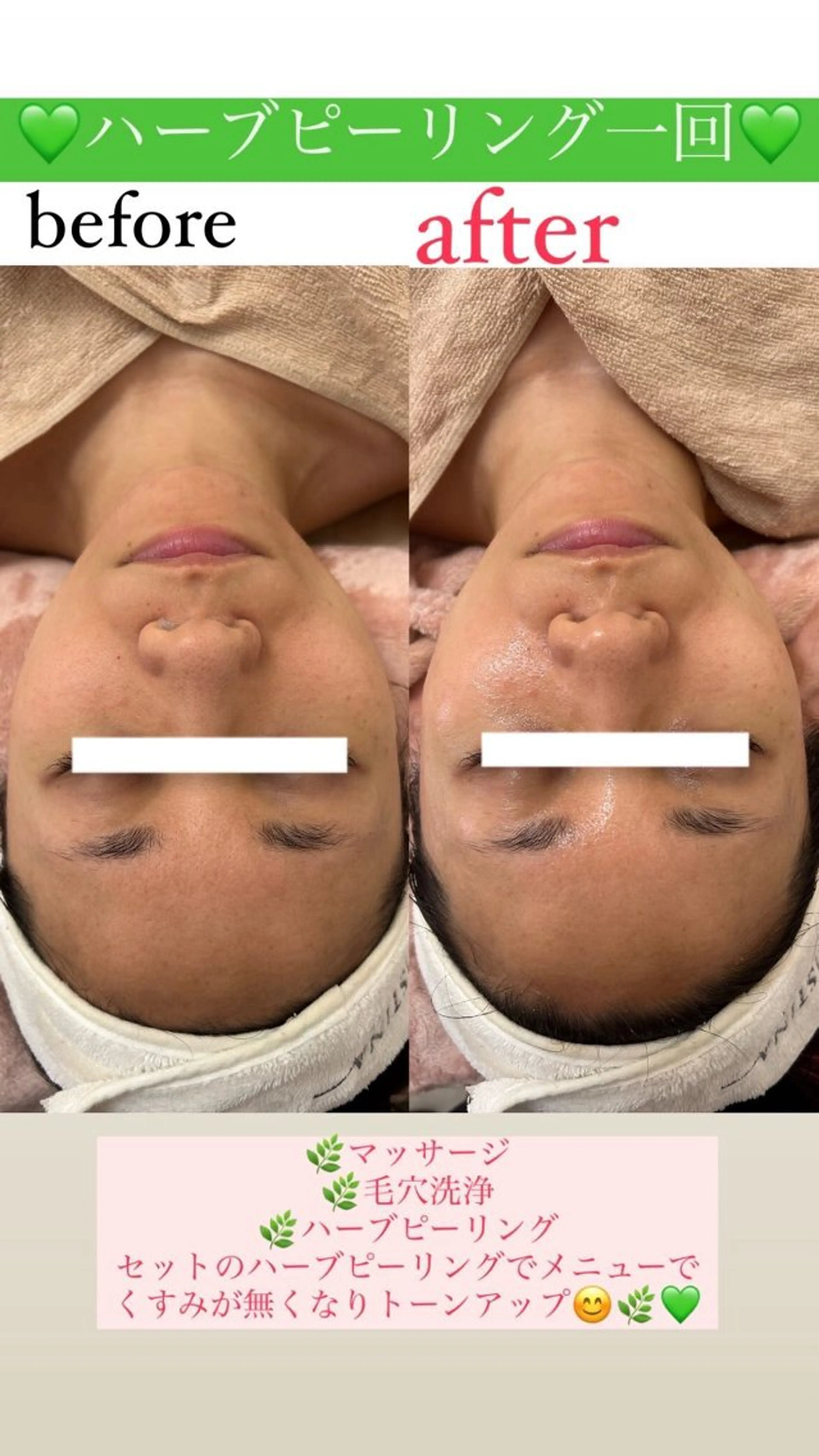 メンズ エステ Salon de Lino 御器所のエステ・リラクイメージ