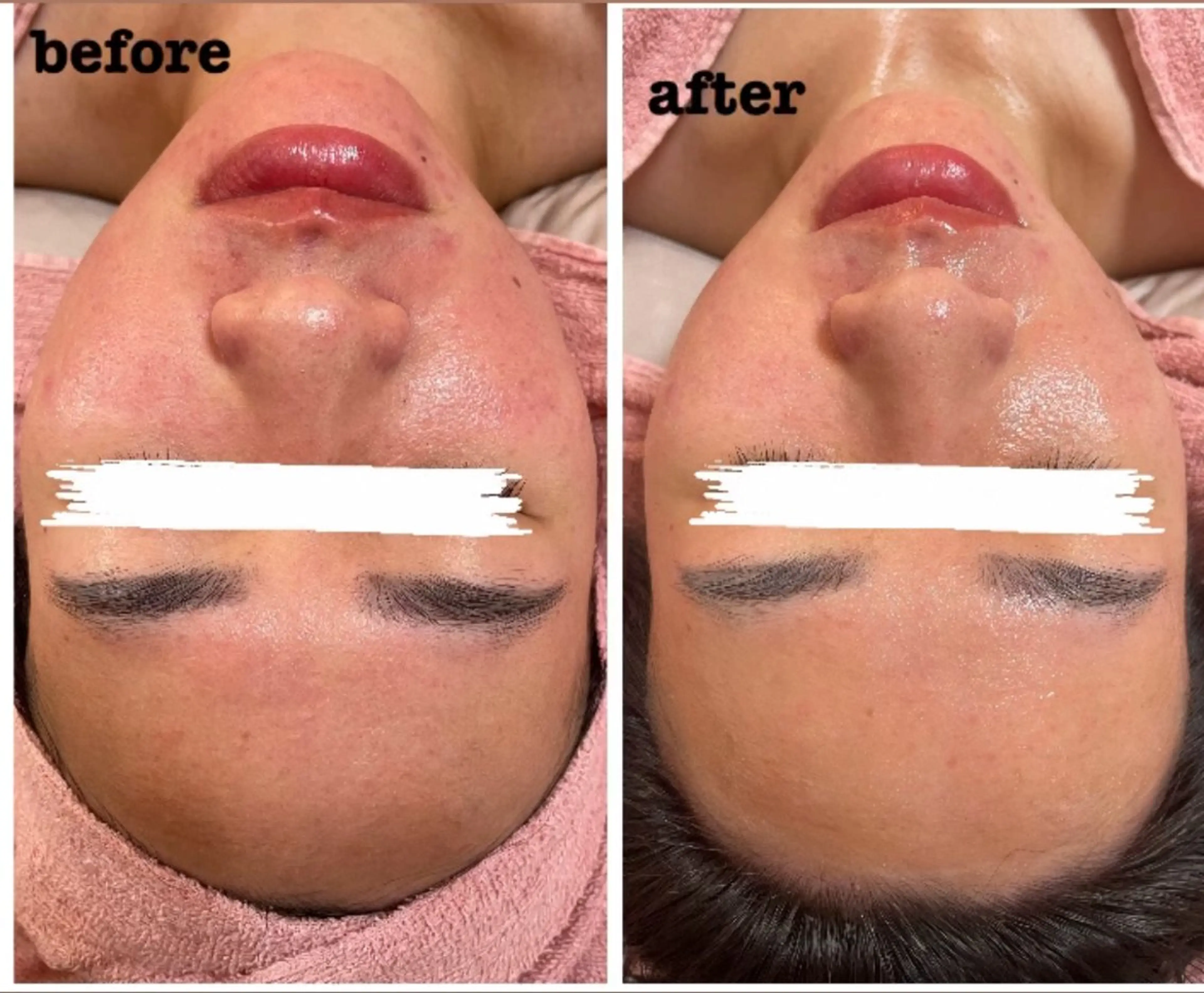 エステ 肌質改善専門店/絹々(きぬ)所属・心満たされる ハーブピーリング絹々のエステ・リラクイメージ