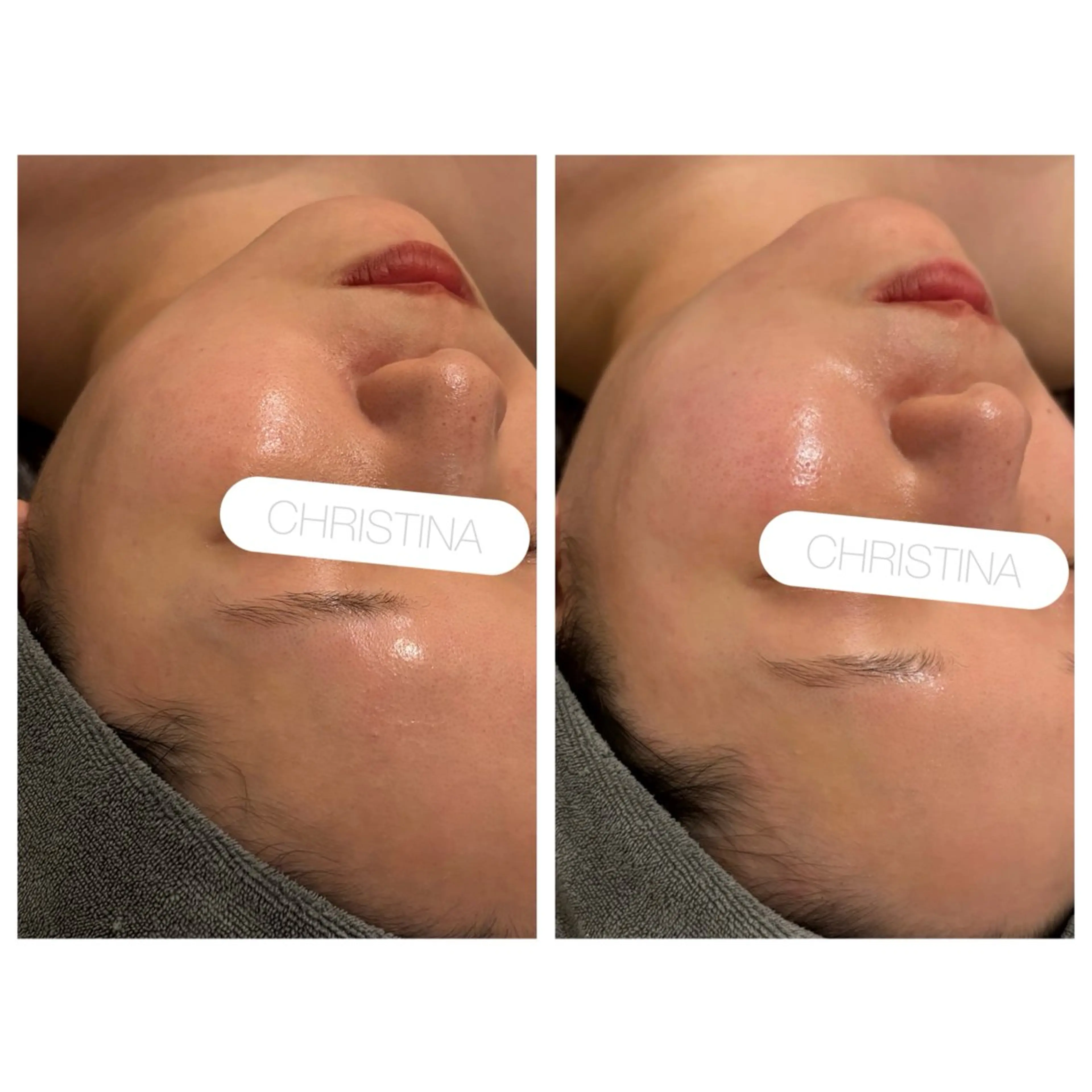 小顔コルギ ☆表参道/外苑前のエステ・リラクイメージ