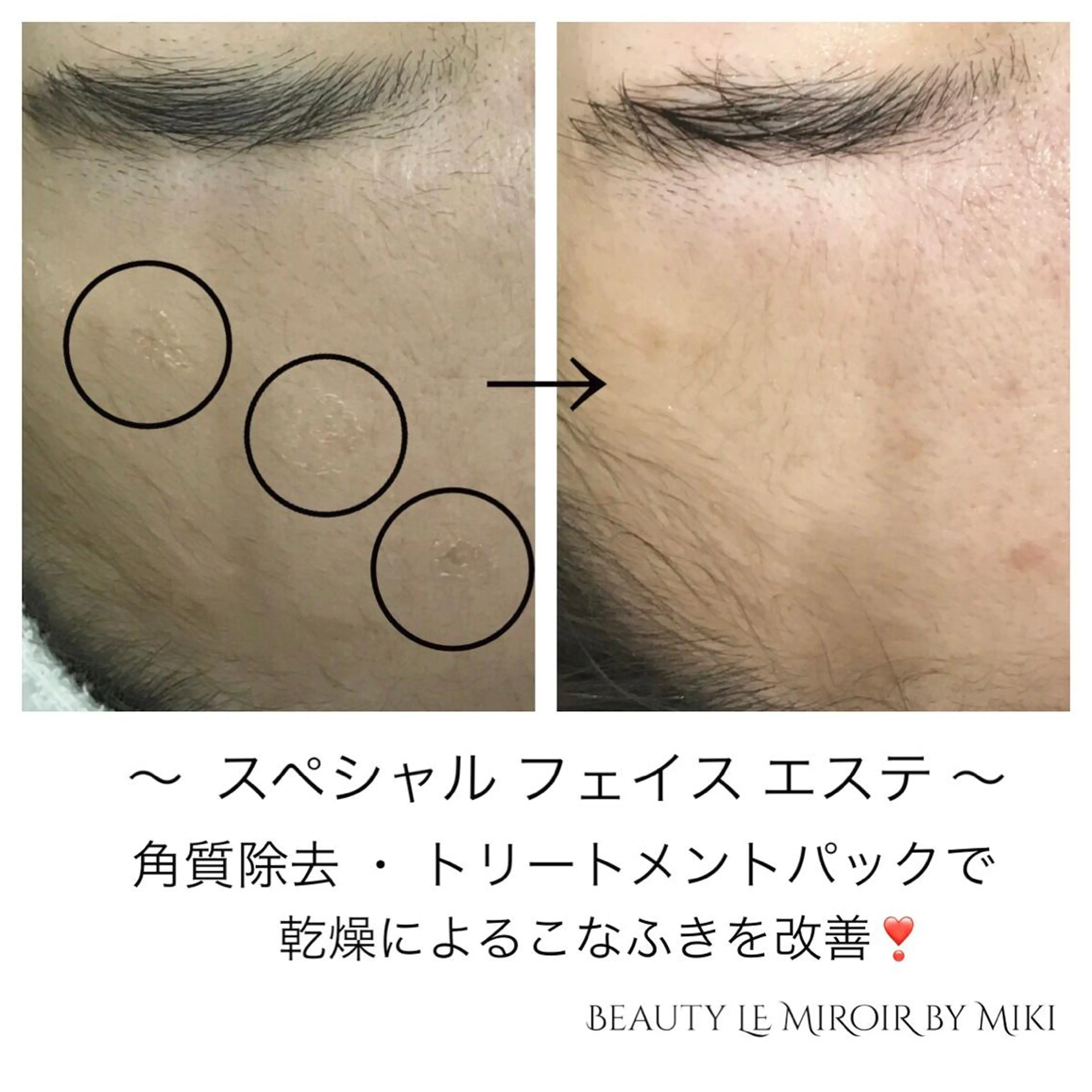 ビューティー ミロワールのエステ・リラクイメージ