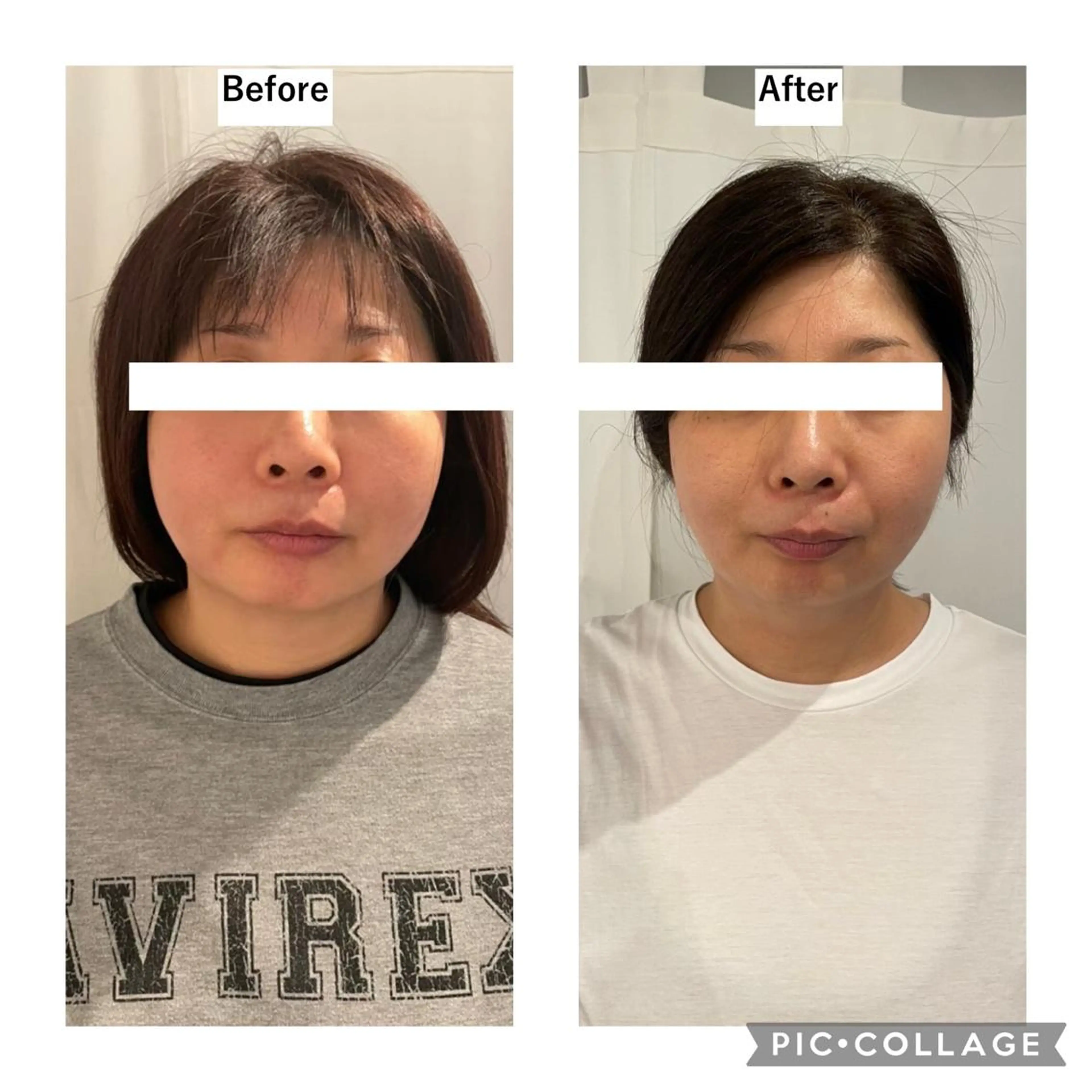 12Dハイフ💗 最強小顔のエステ・リラクイメージ