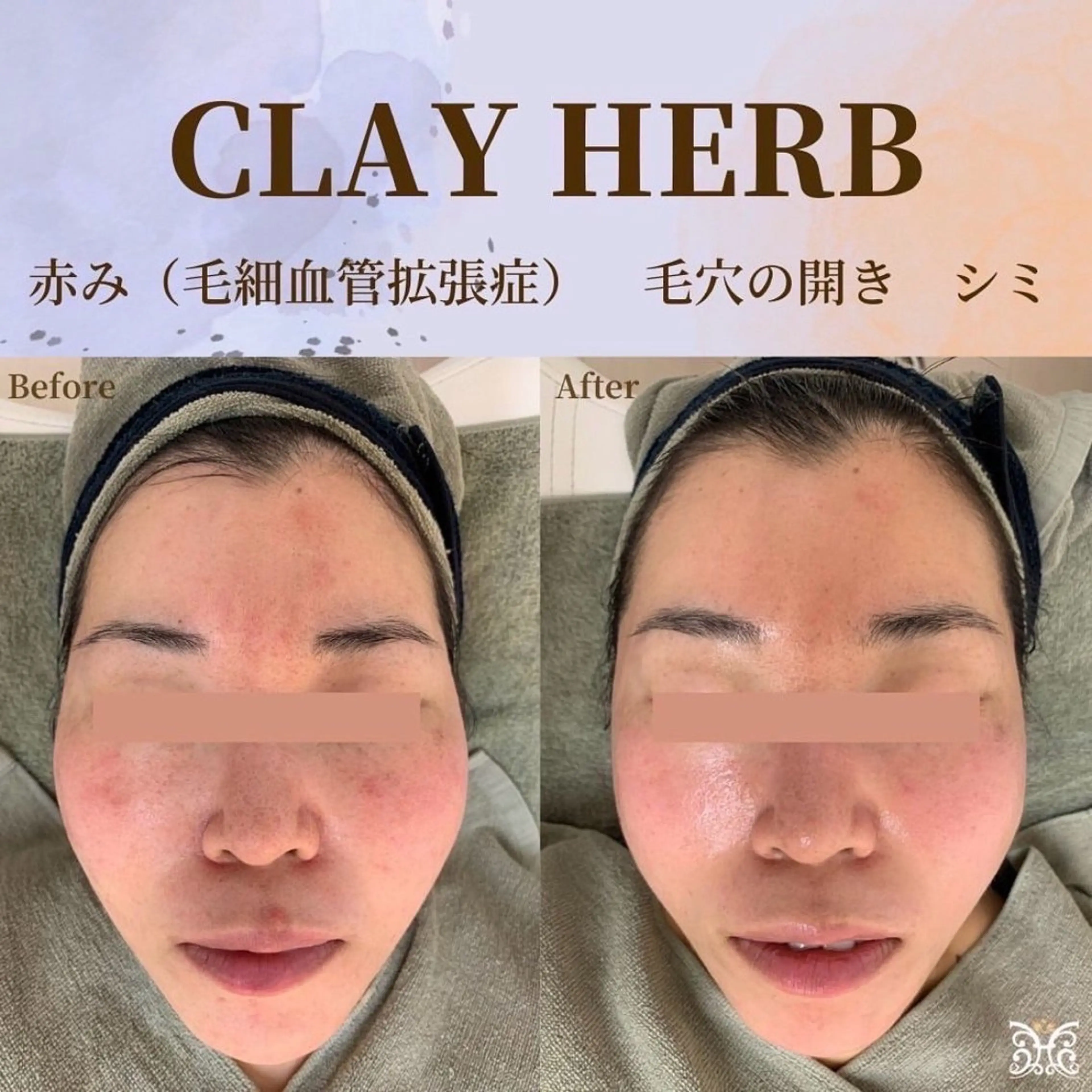 エステ デトックス専門サロン ココシュエットのエステ・リラクイメージ