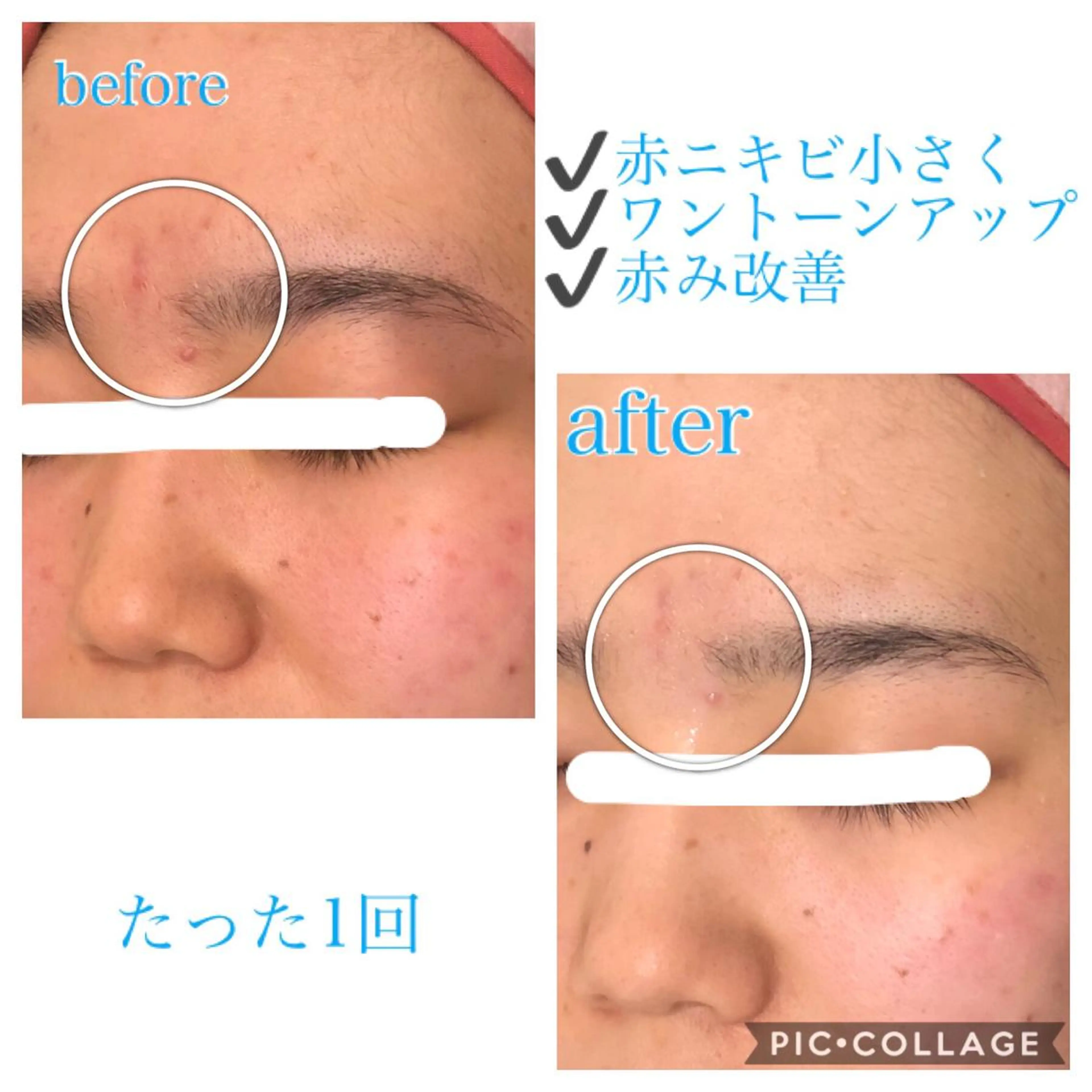 ミディアム カラー パーマ ヘアアレンジ キッズ ネイル マツエク・マツパ エステ リラク EnsorClair 代表 野口真央のエステ・リラクイメージ