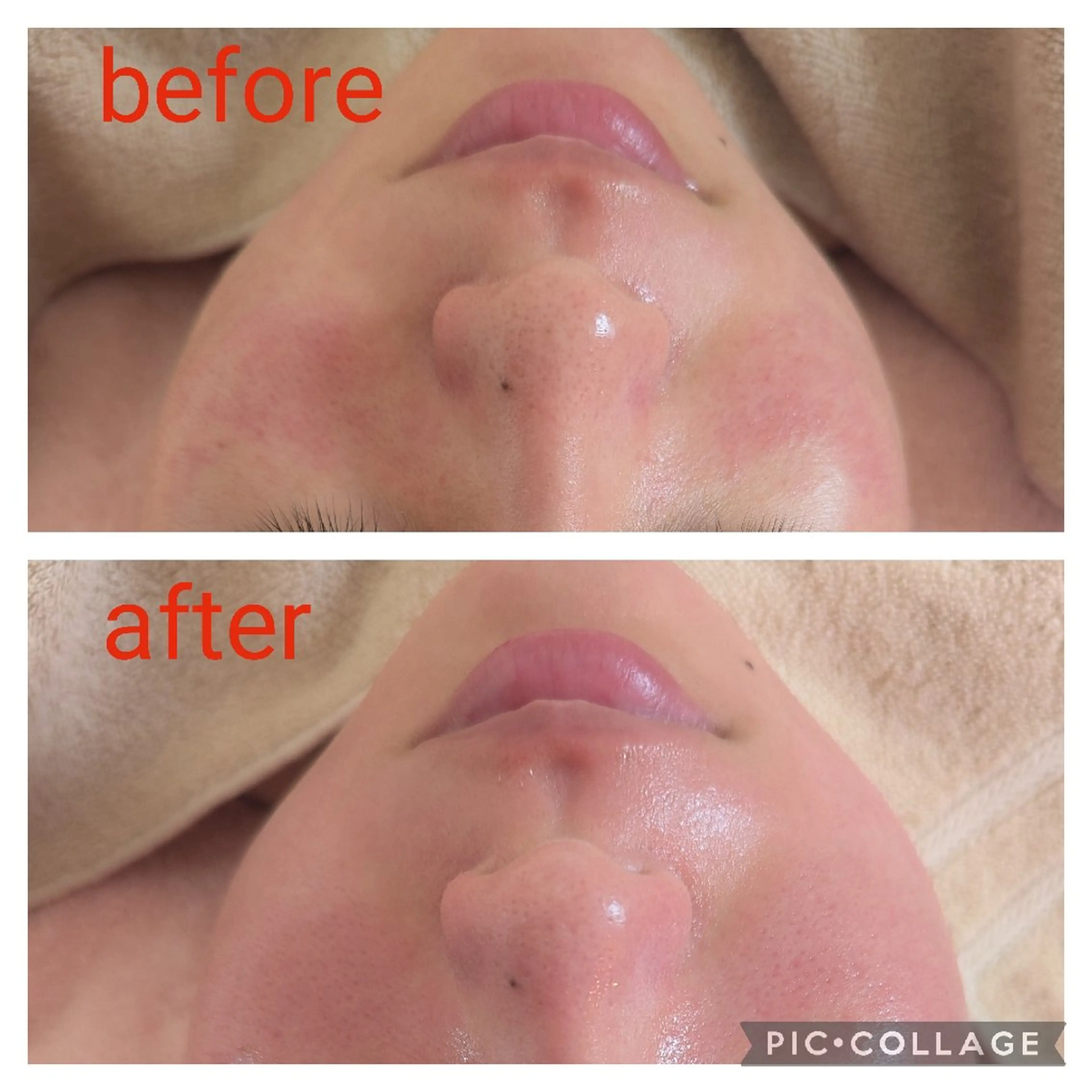 ユテラ 佑來（ゆき）のエステ・リラクイメージ