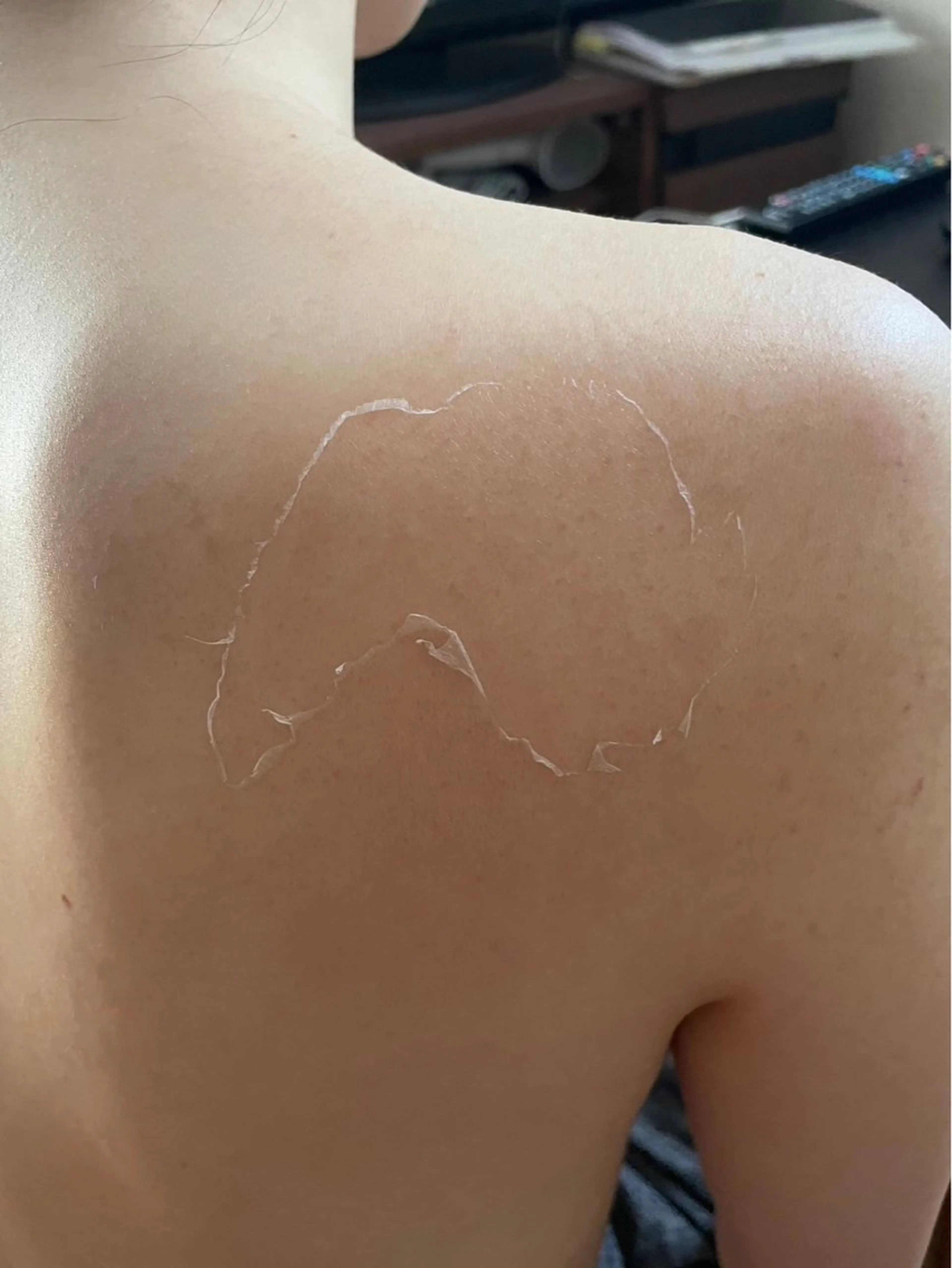 エステ clé skin 🌿ハーブピーリングのエステ・リラクイメージ