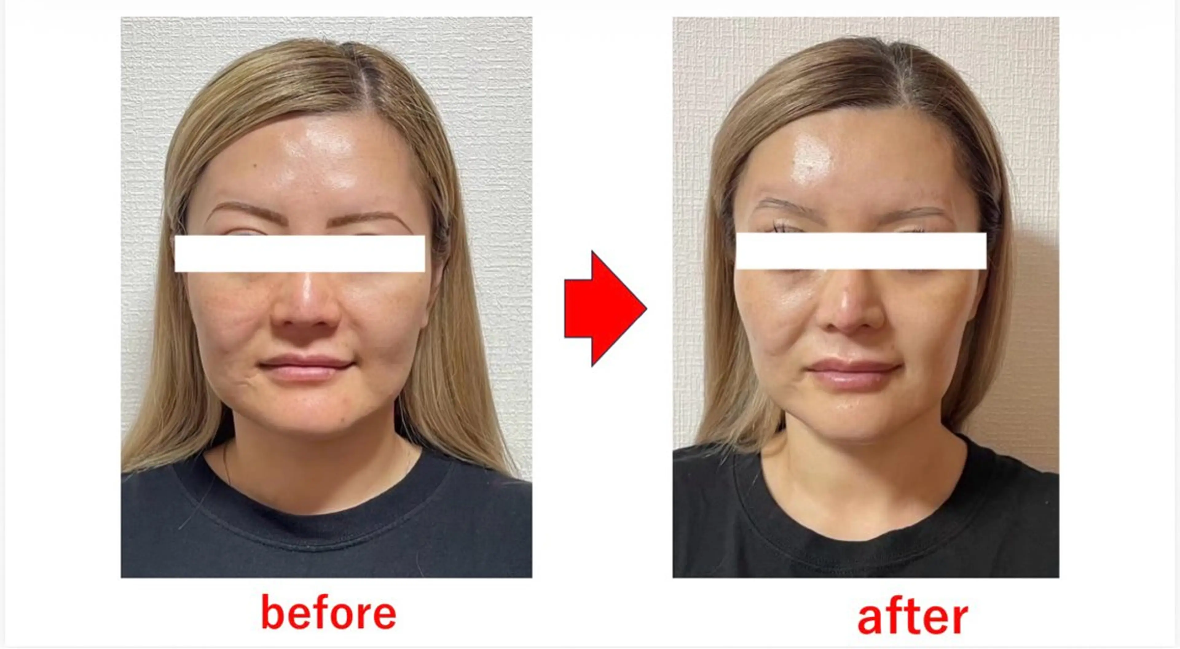 ブプラ 倉敷店のエステ・リラクイメージ