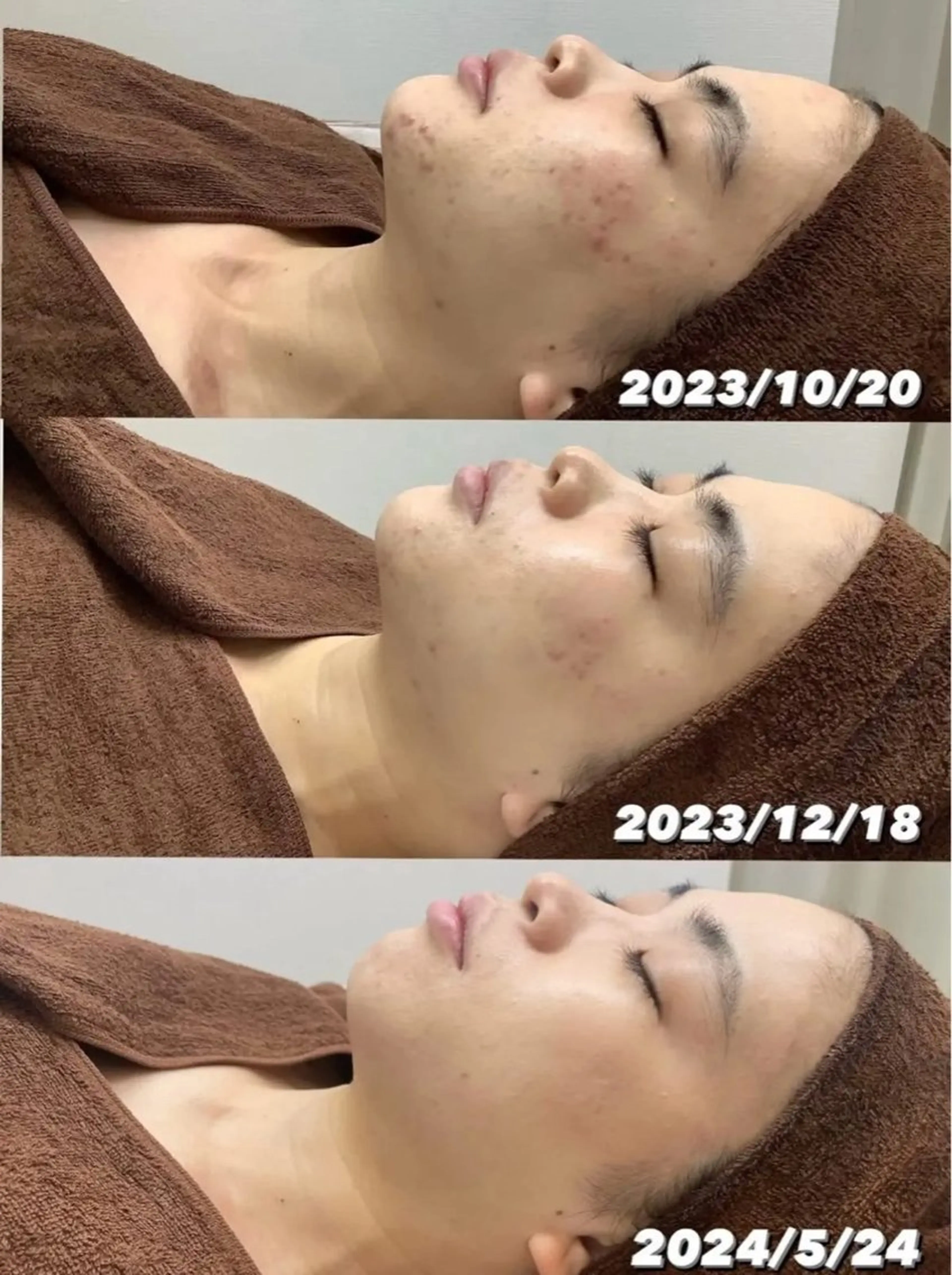 エステ レイエステティック スタッフのエステ・リラクイメージ