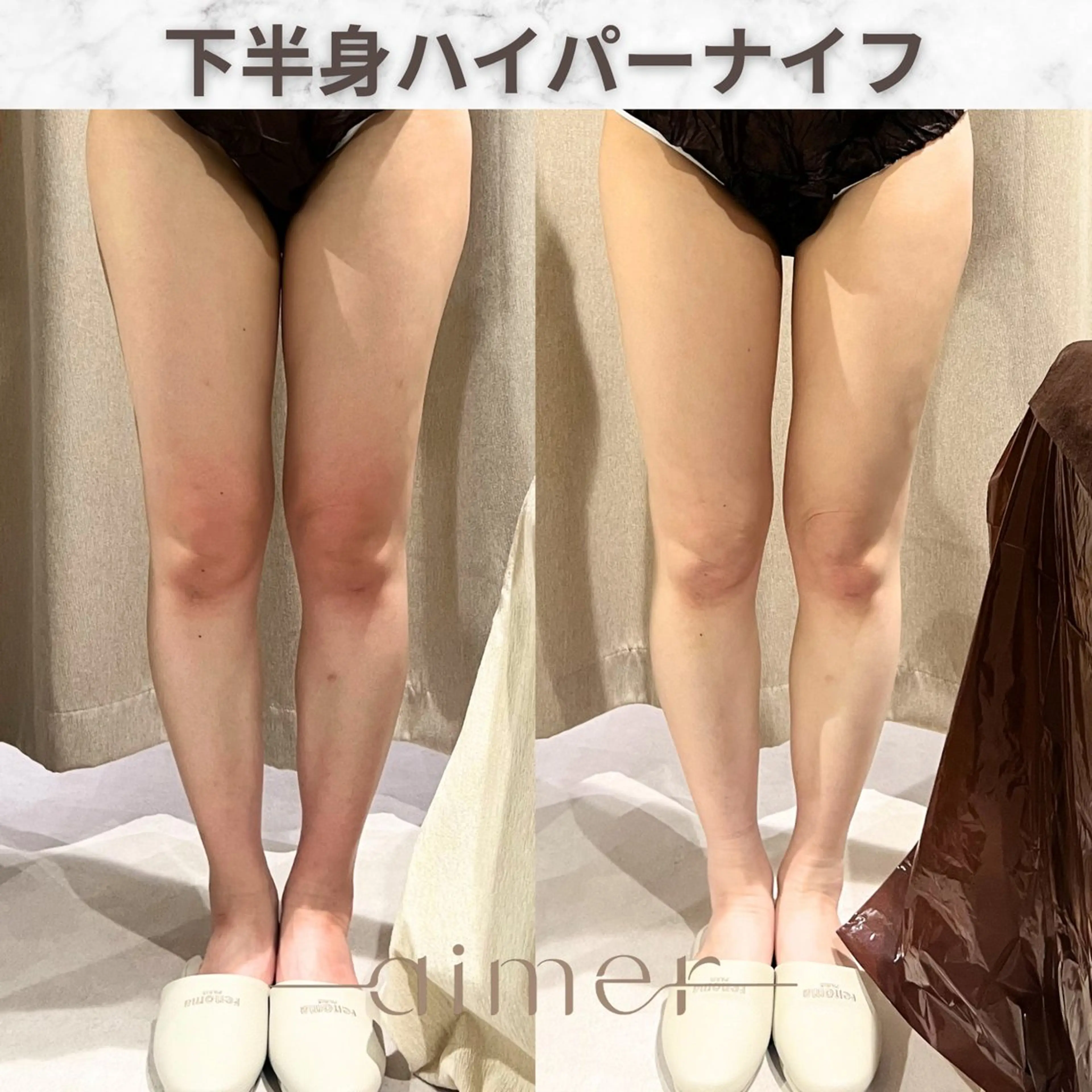 aimer服部 /  小顔 ・ 痩身のその他イメージ