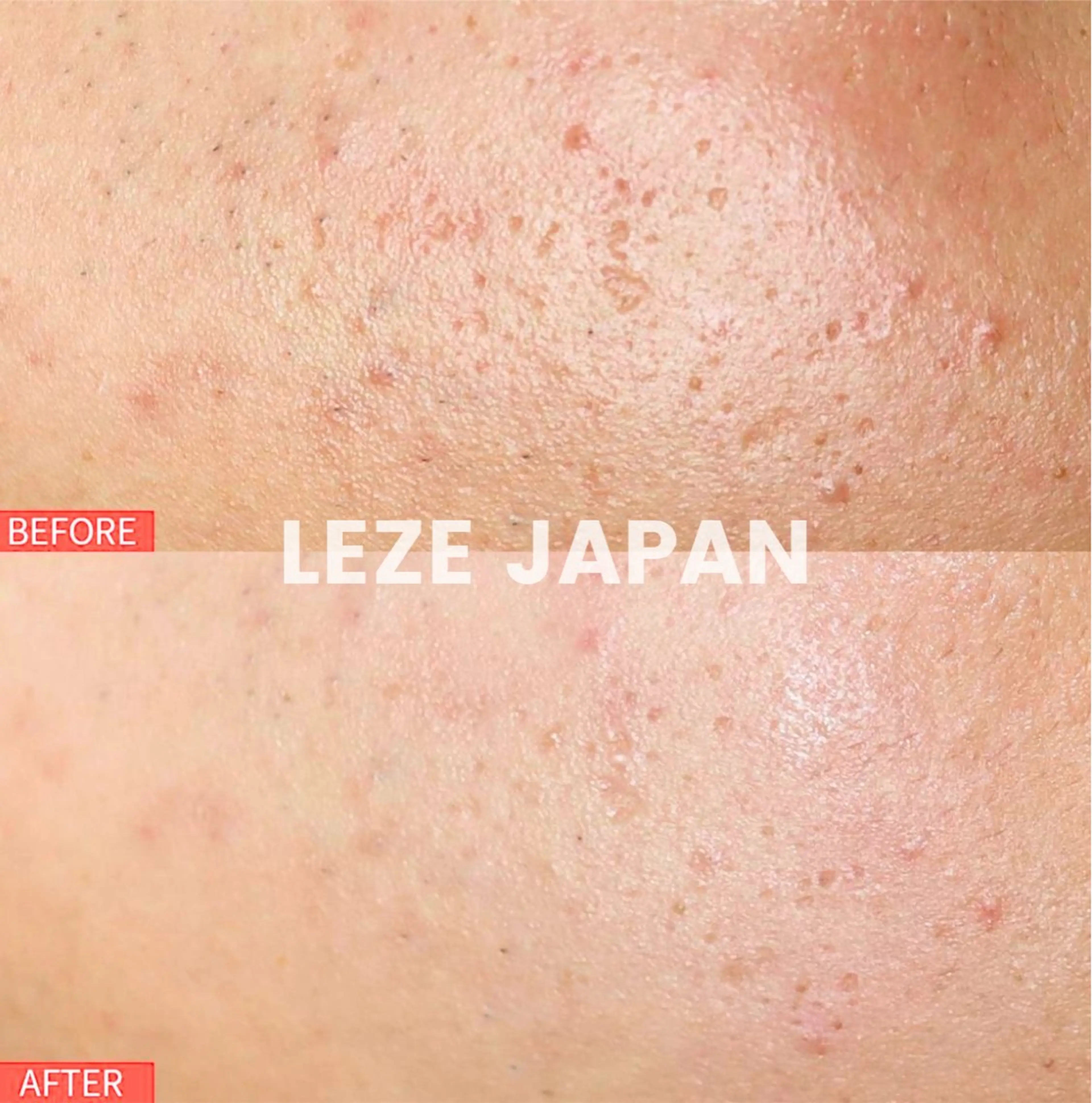 LA CLARTEのエステ・リラクイメージ