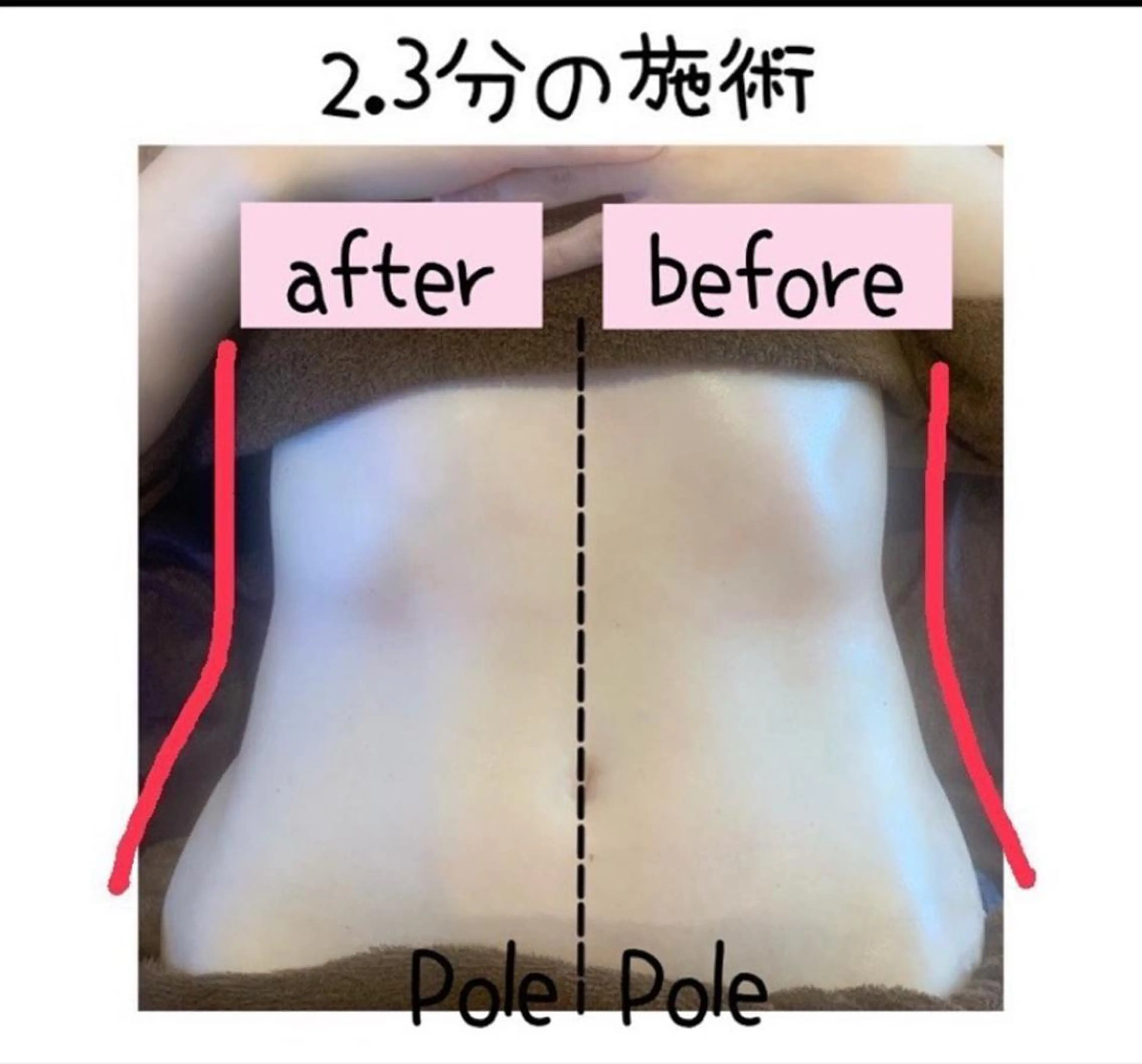 【1番人気】　コリ＆痩身コース　90分の写真