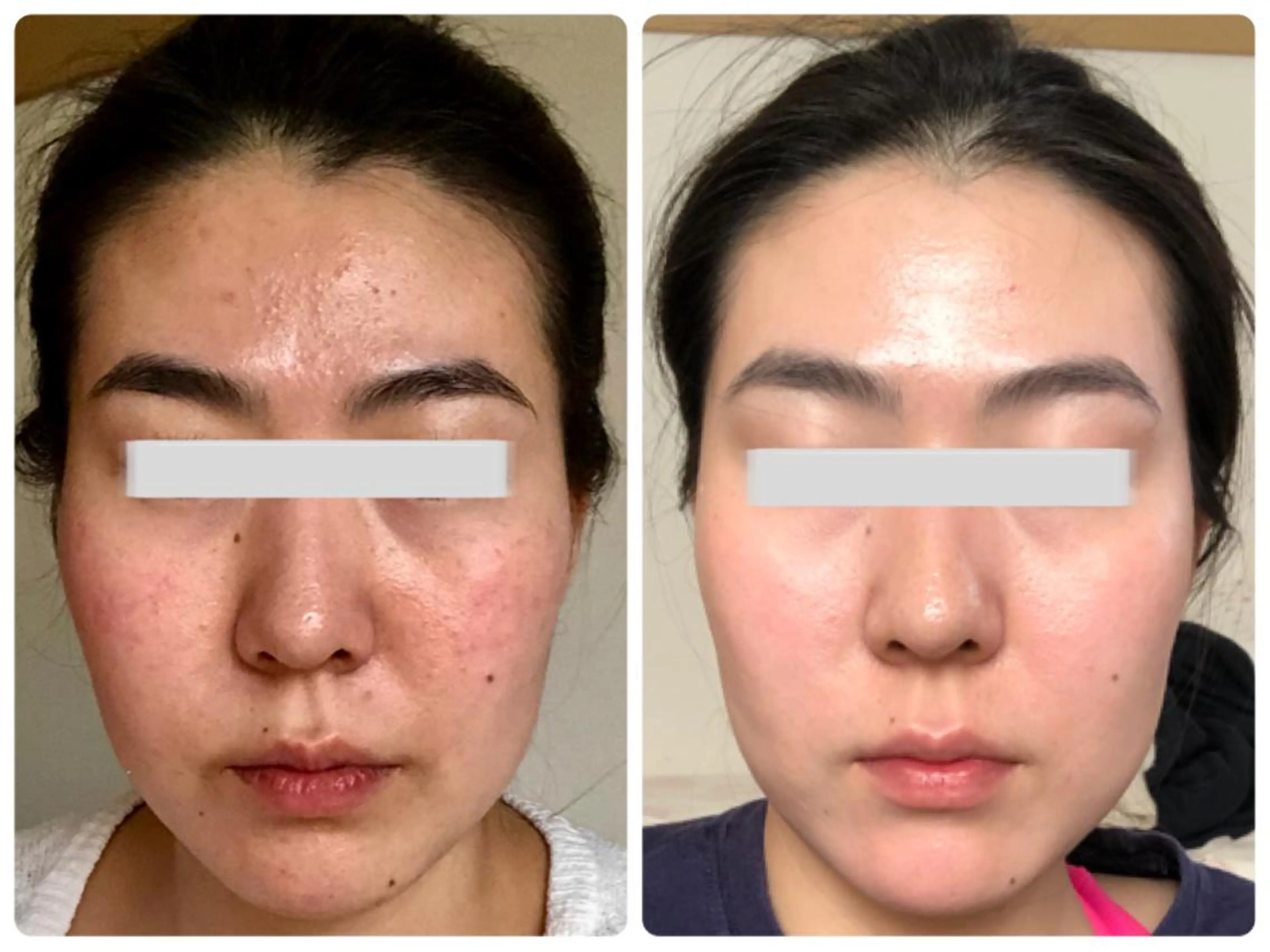 エステ 肌質改善サロン La Divinaのエステ・リラクイメージ