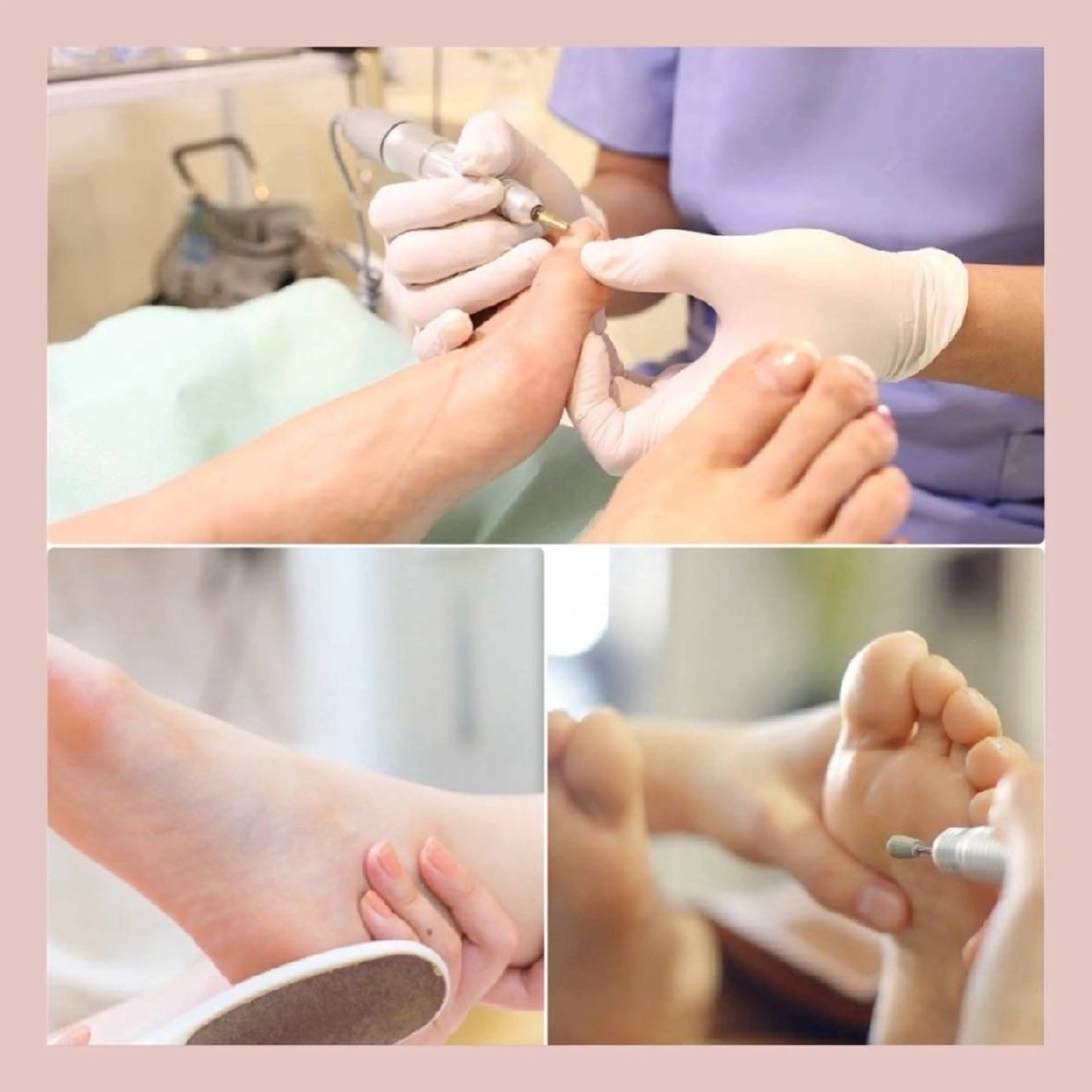 巻き爪補正店 大阪なんば店のネイルデザイン