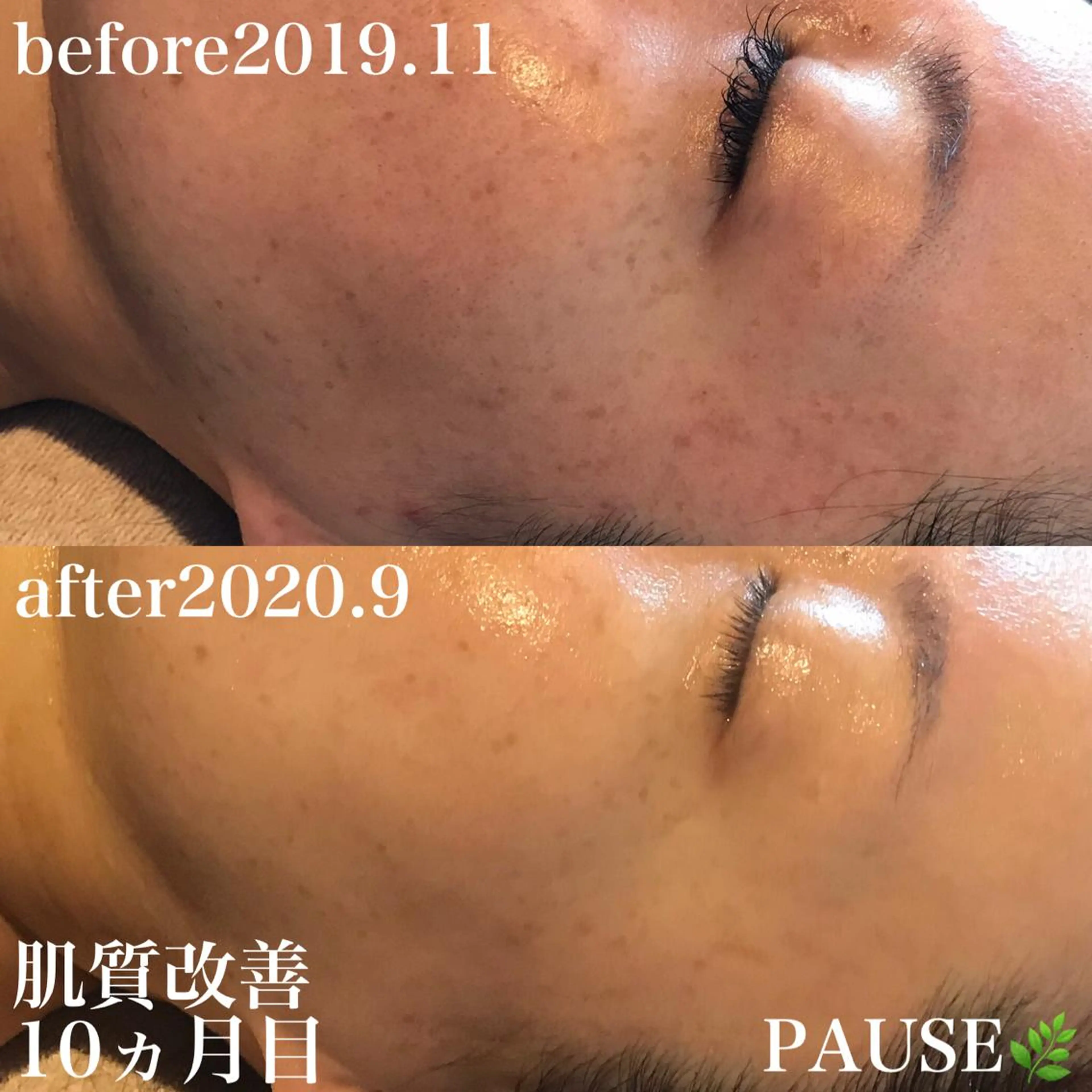 エステ 浜野 恵美のエステ・リラクイメージ