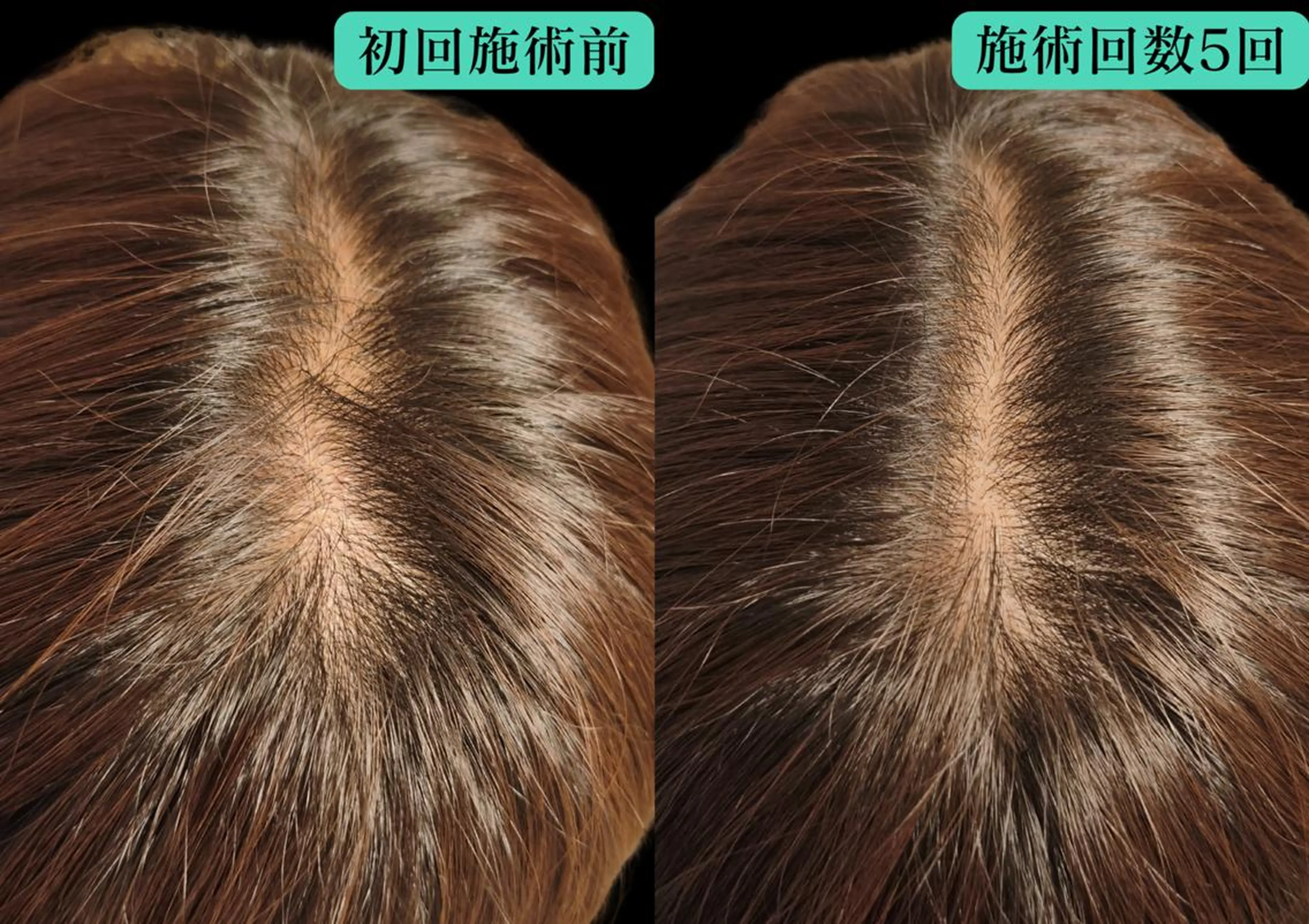 エステ リラク 美容とカラダの鍼灸 サロン やなけんのエステ・リラクイメージ