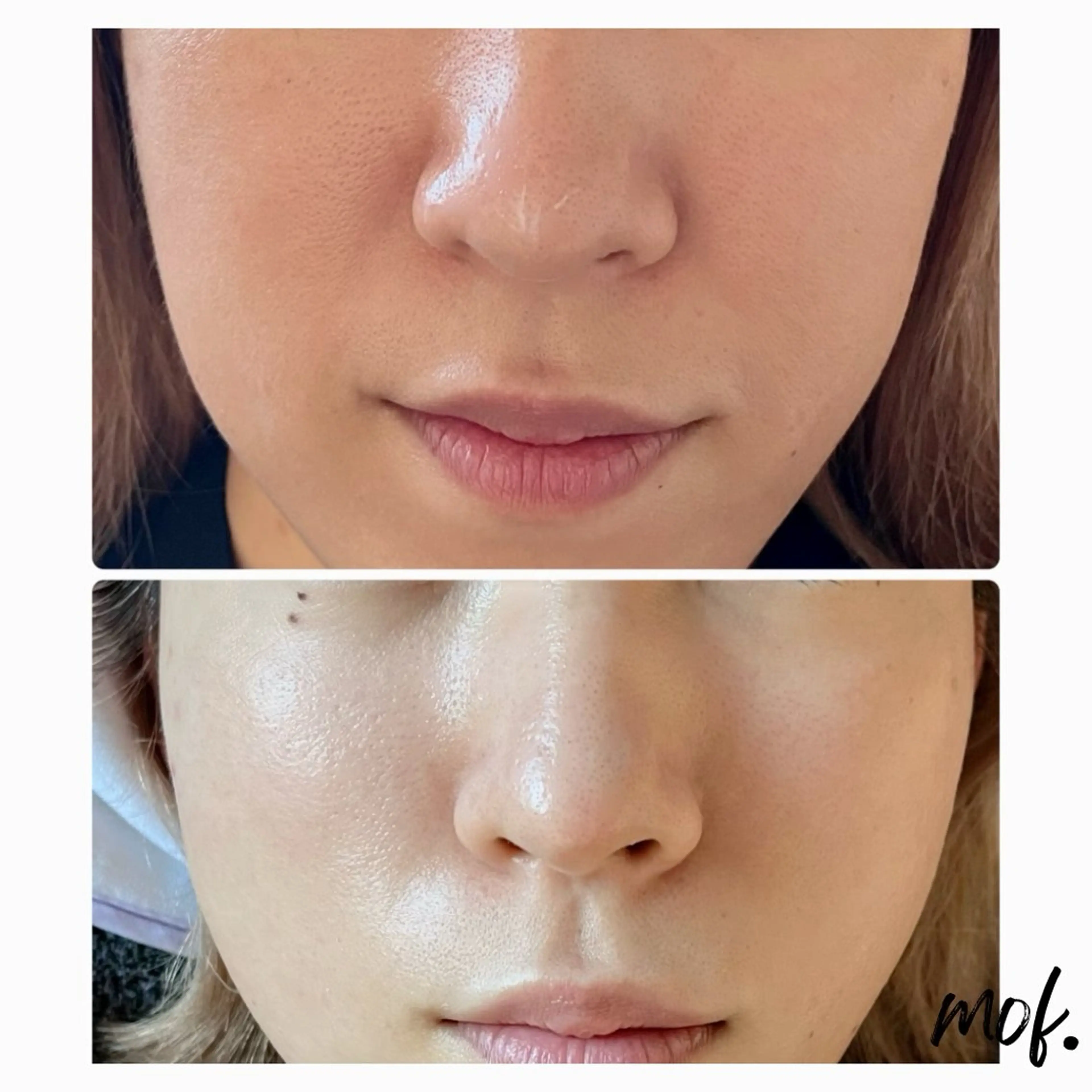 脱毛 mof.(モフ) Horieのその他イメージ