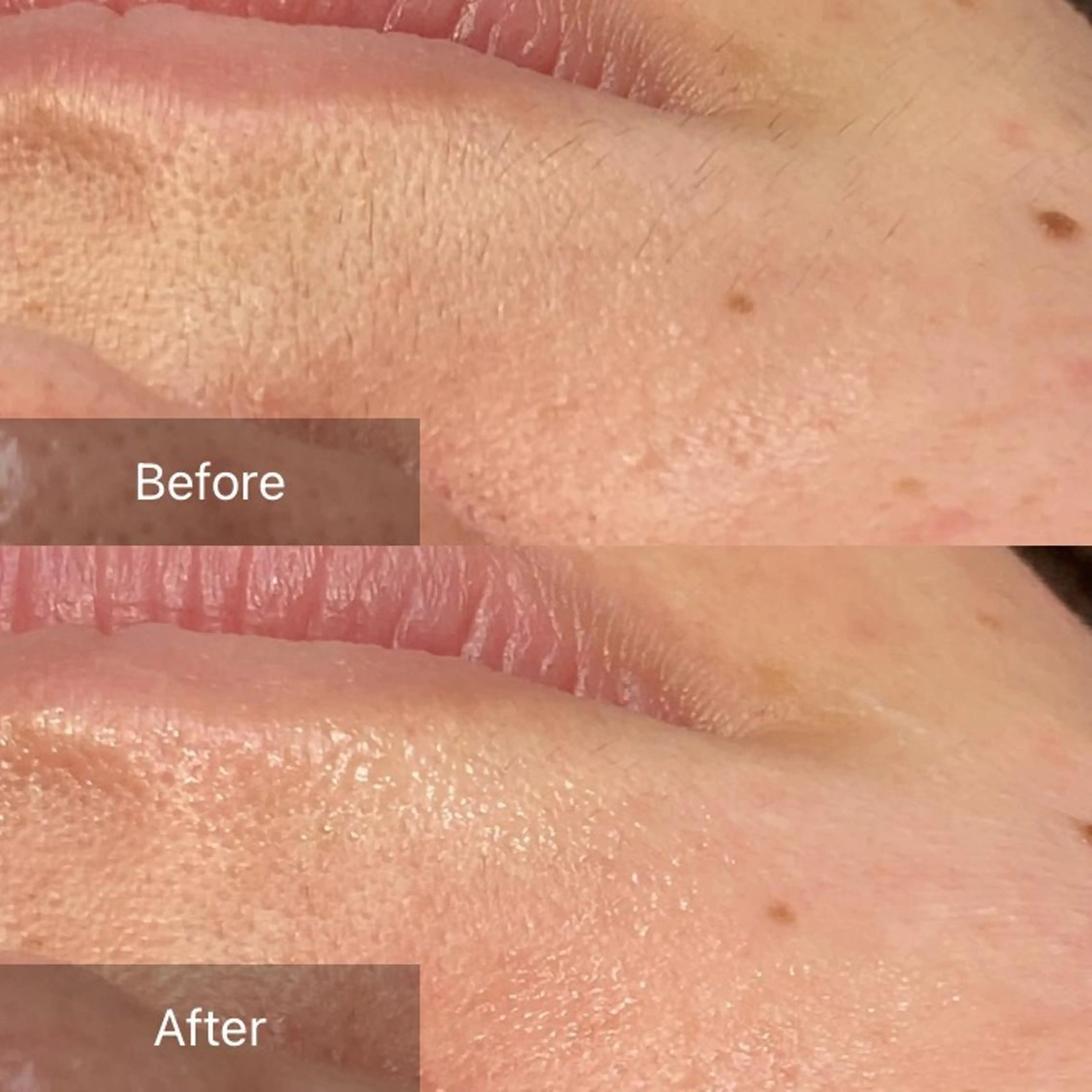 脱毛 産毛専門店 Bittoのエステ・リラクイメージ