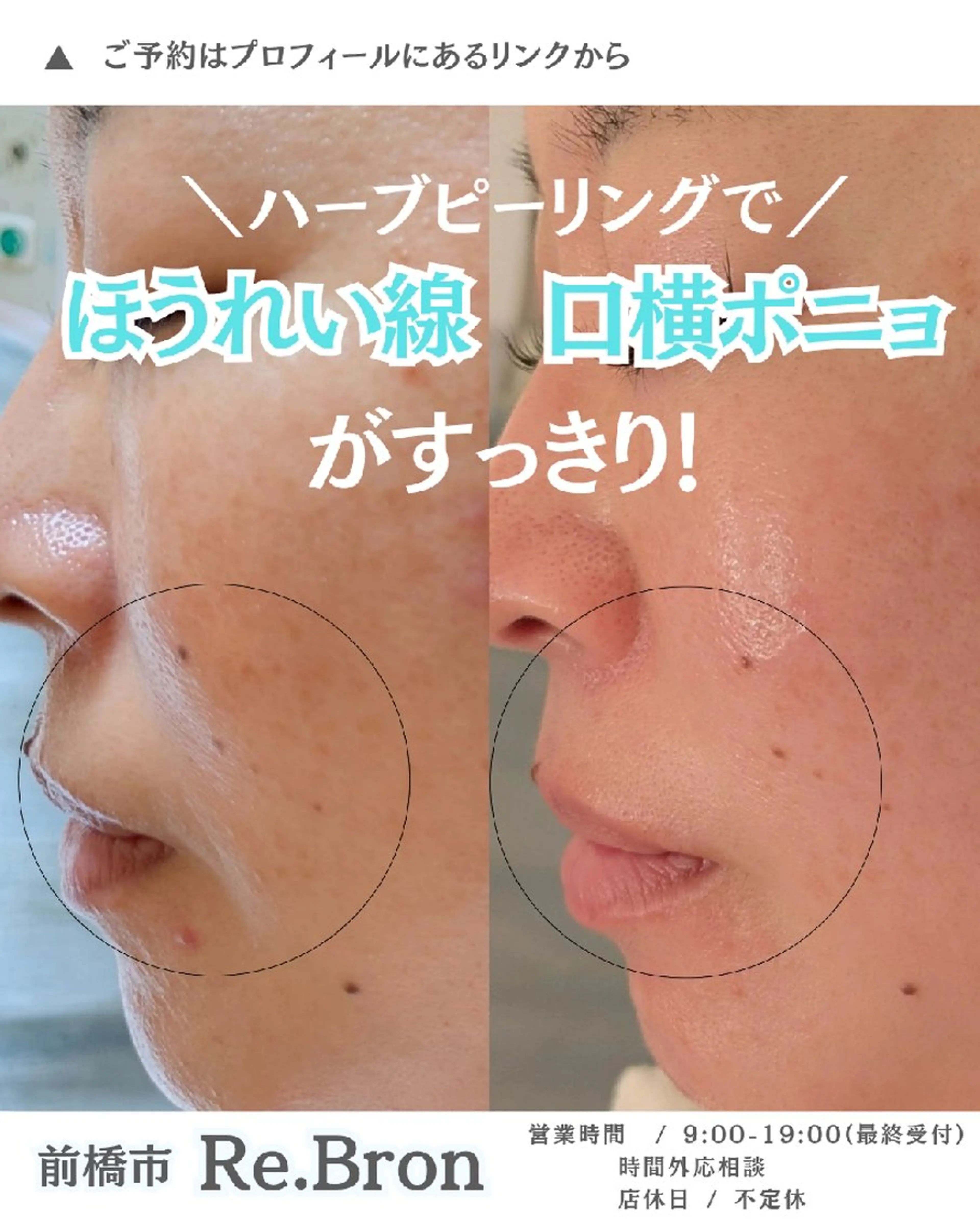 エステ リラク たるみ・ くすみ シミ・ニキビ肌改善のエステ・リラクイメージ