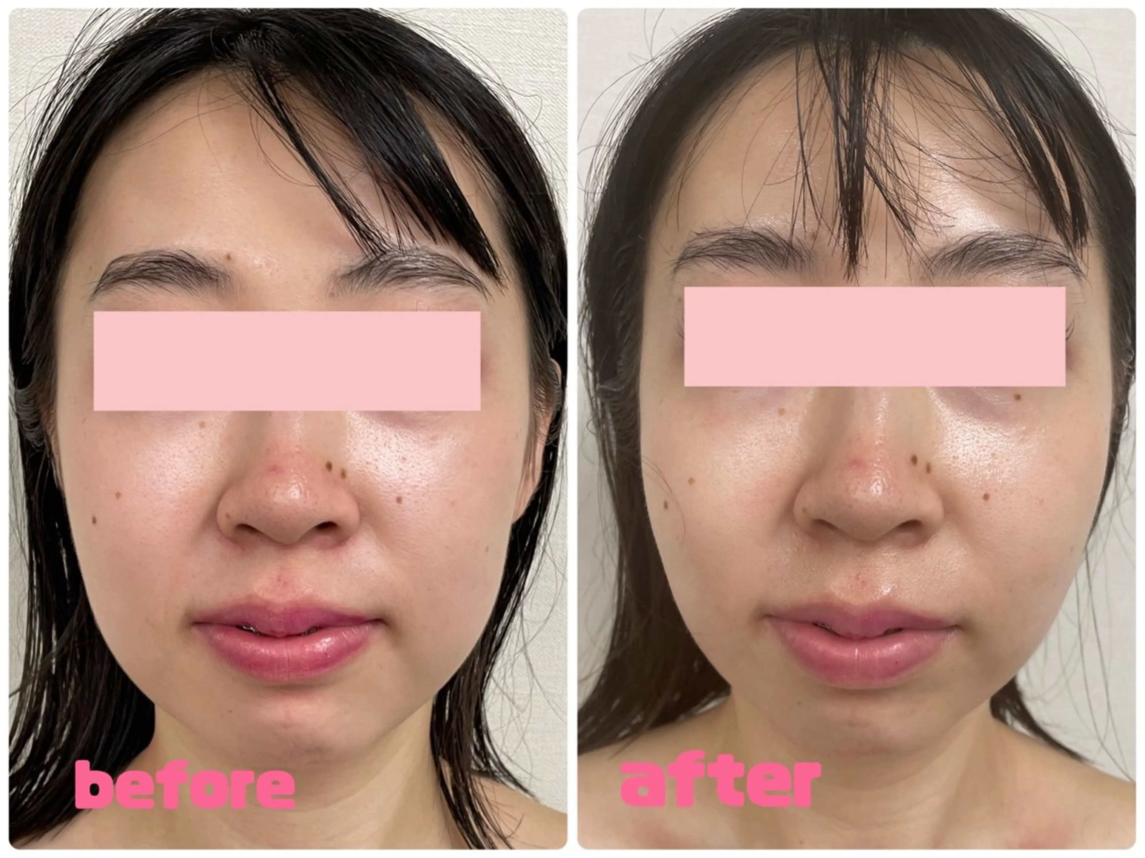 大人気‼️痛くない小顔コルギ【リフトアップヘッドマッサージ】付の写真