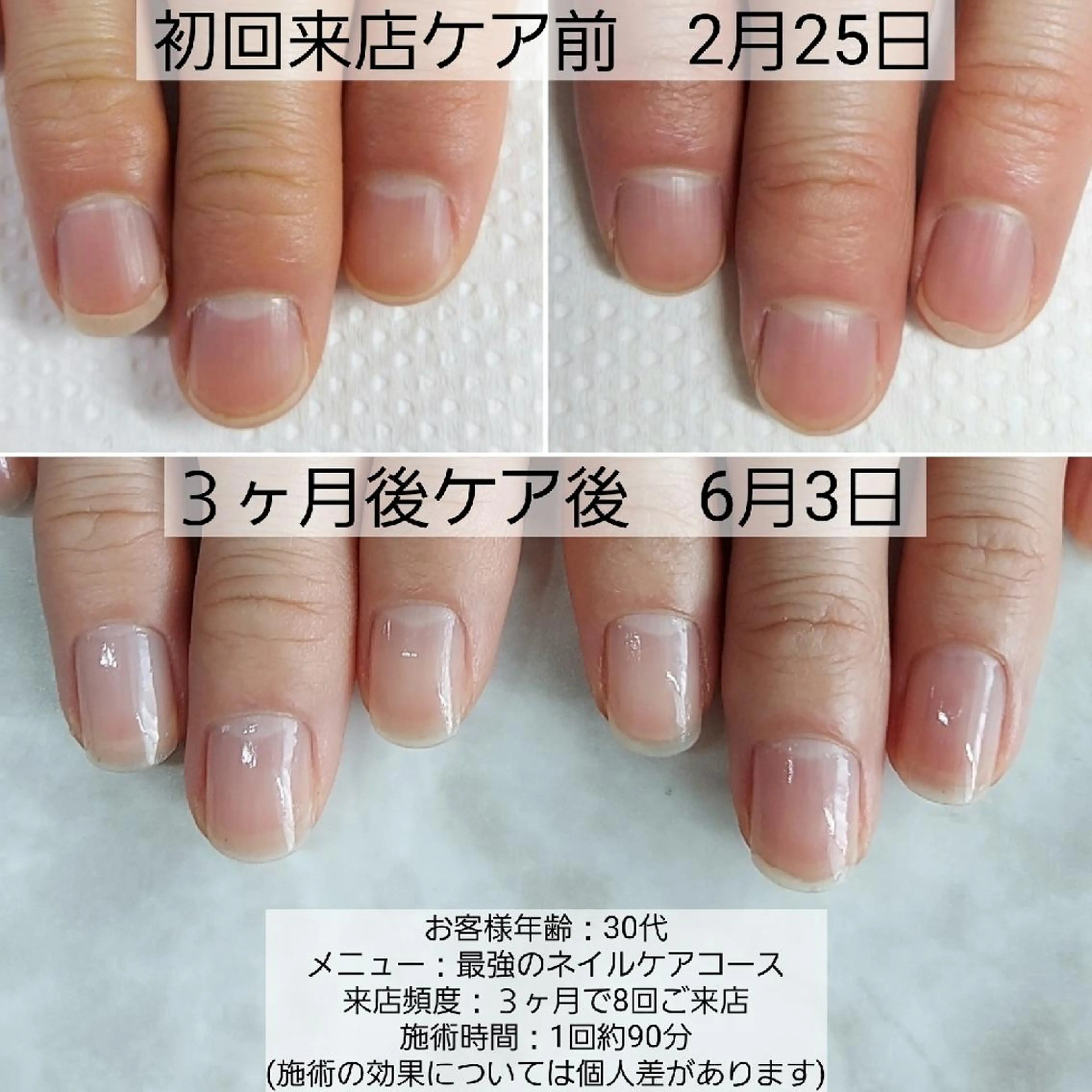 ナチュラル自爪育成の写真