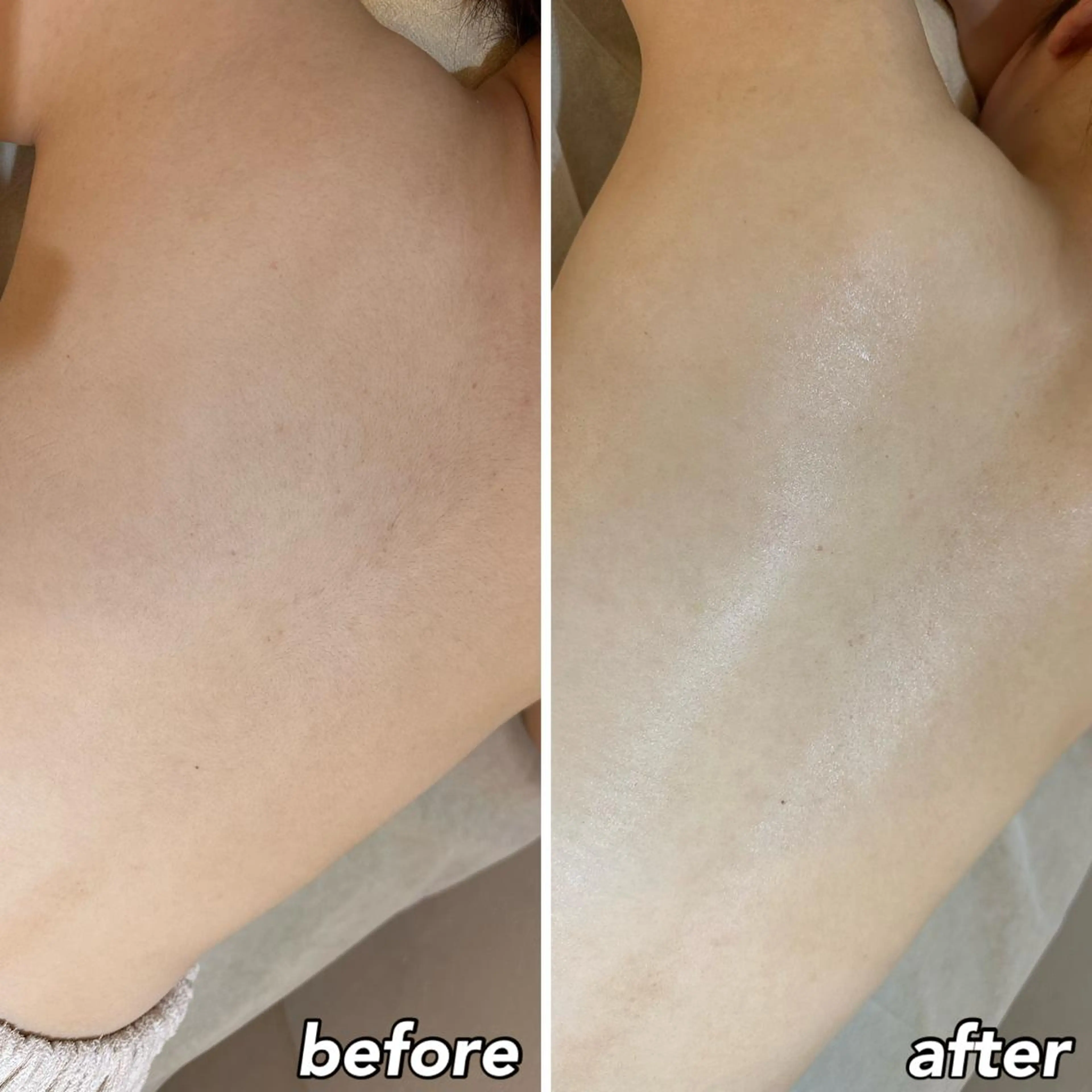 うなじ脱毛/美肌脱毛 LABELのエステ・リラクイメージ