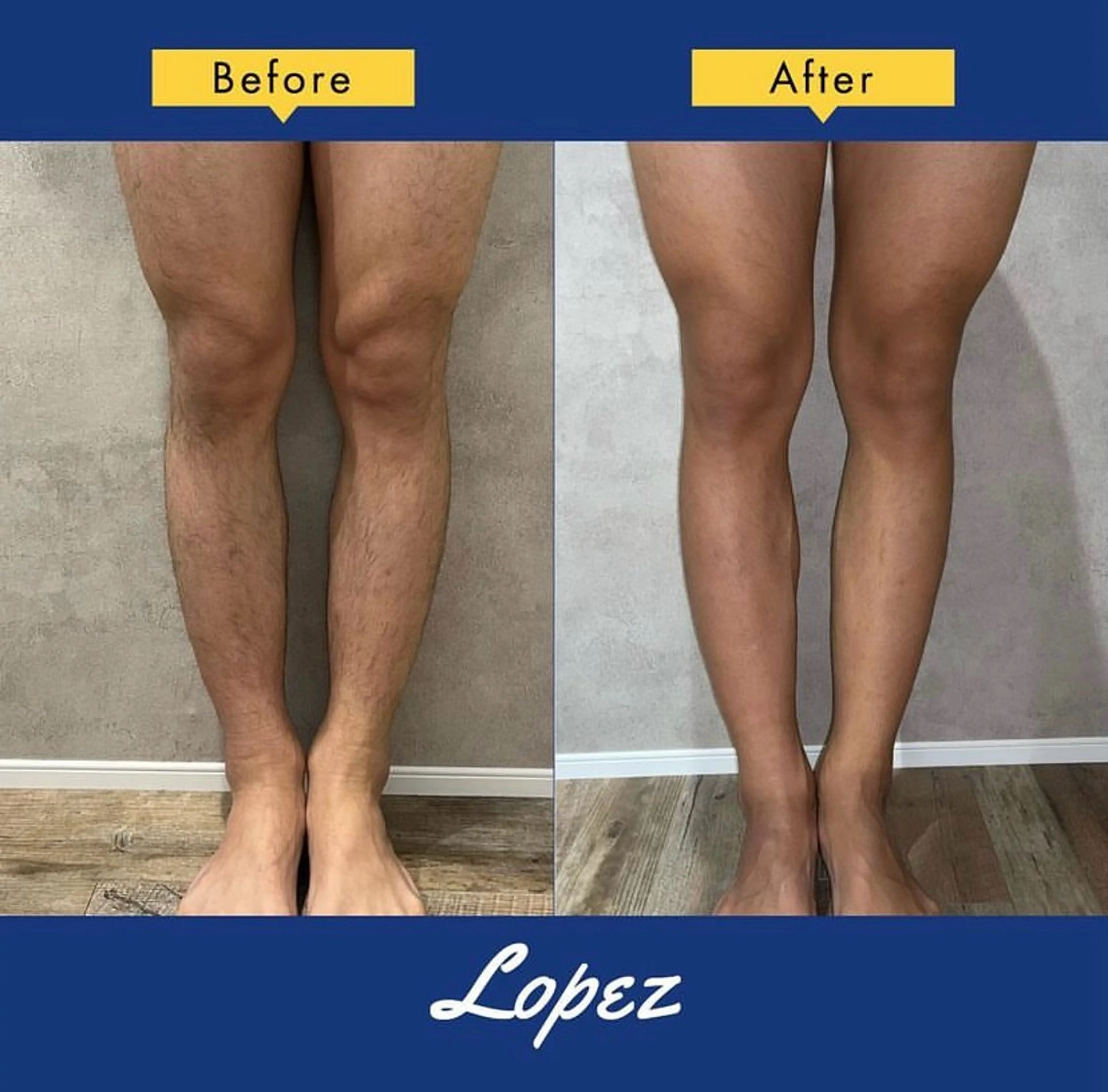 メンズ メンズ脱毛エステサロンロペス所属・小池 里穂のエステ・リラクイメージ