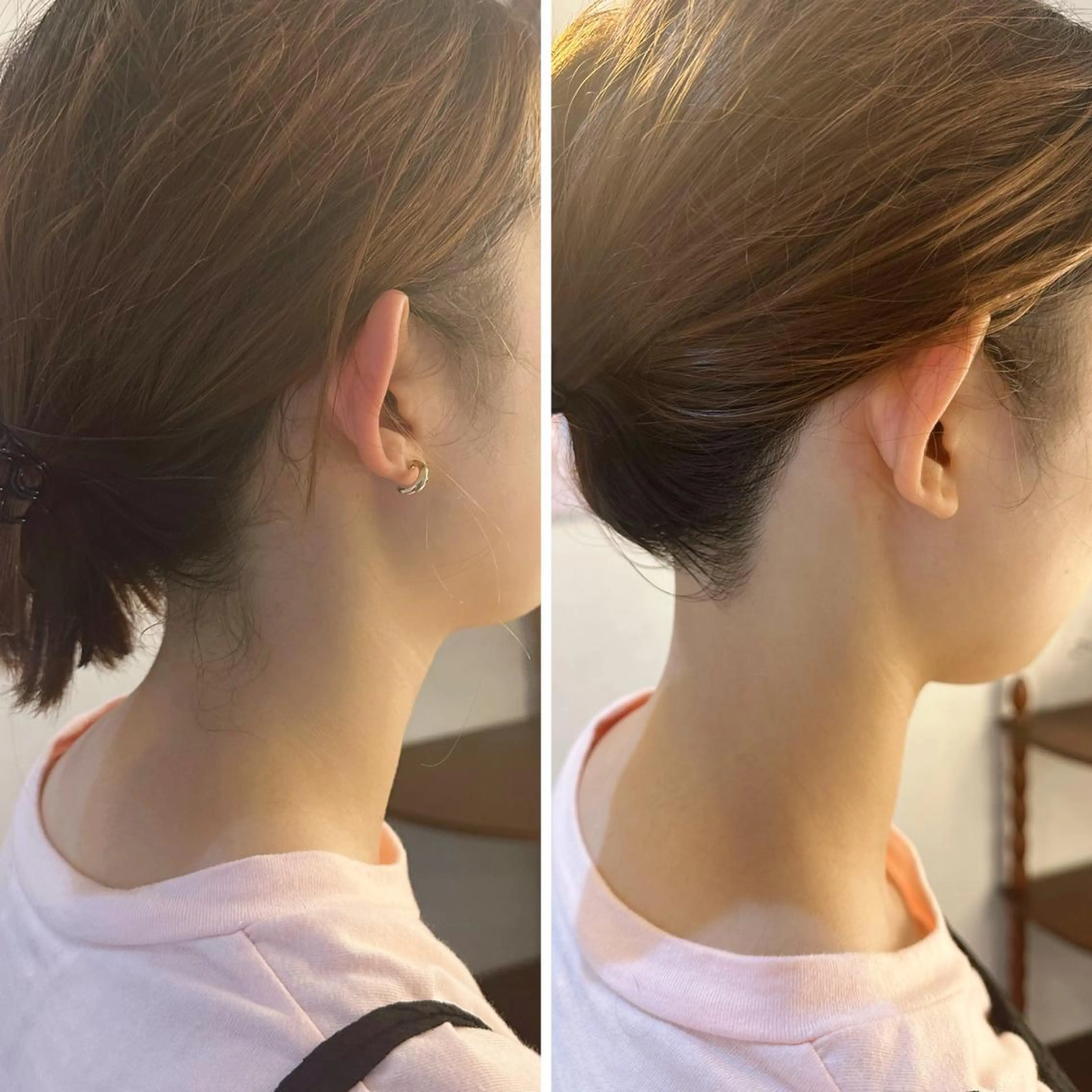 脱毛 うなじ脱毛/美肌脱毛 LABELのエステ・リラクイメージ