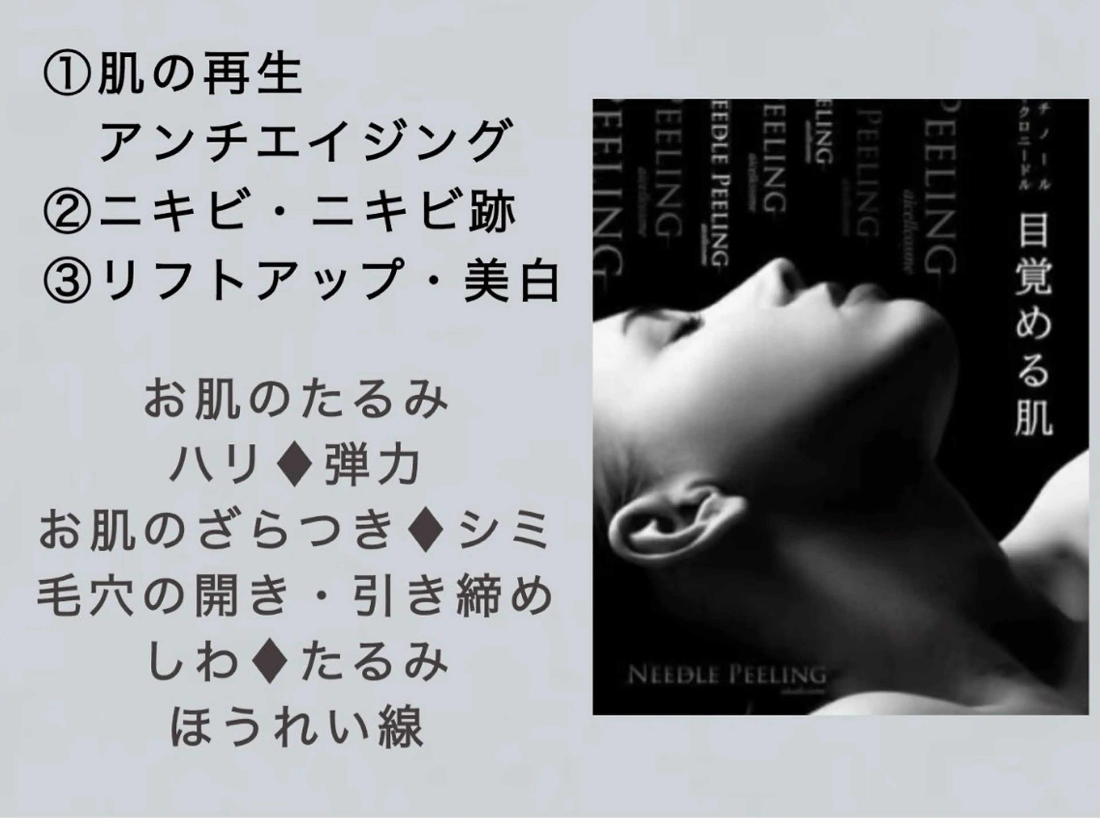 マイクロニードルトリートメント　通常9,800円→初回限定7,000円の写真