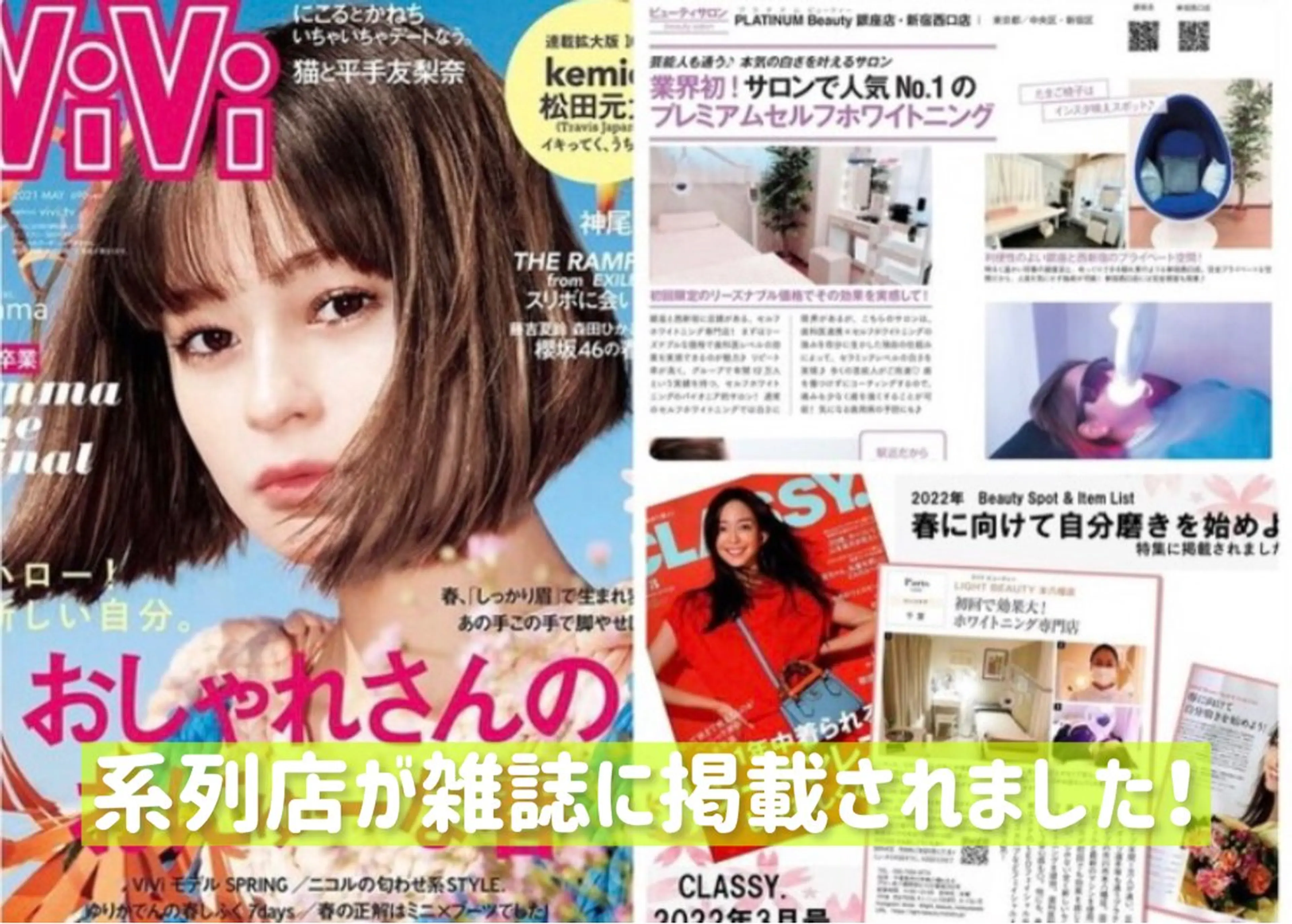 プラチナムビューティー柏所属・【歯科提携】柏ホワイ トニングスタイルのその他イメージ