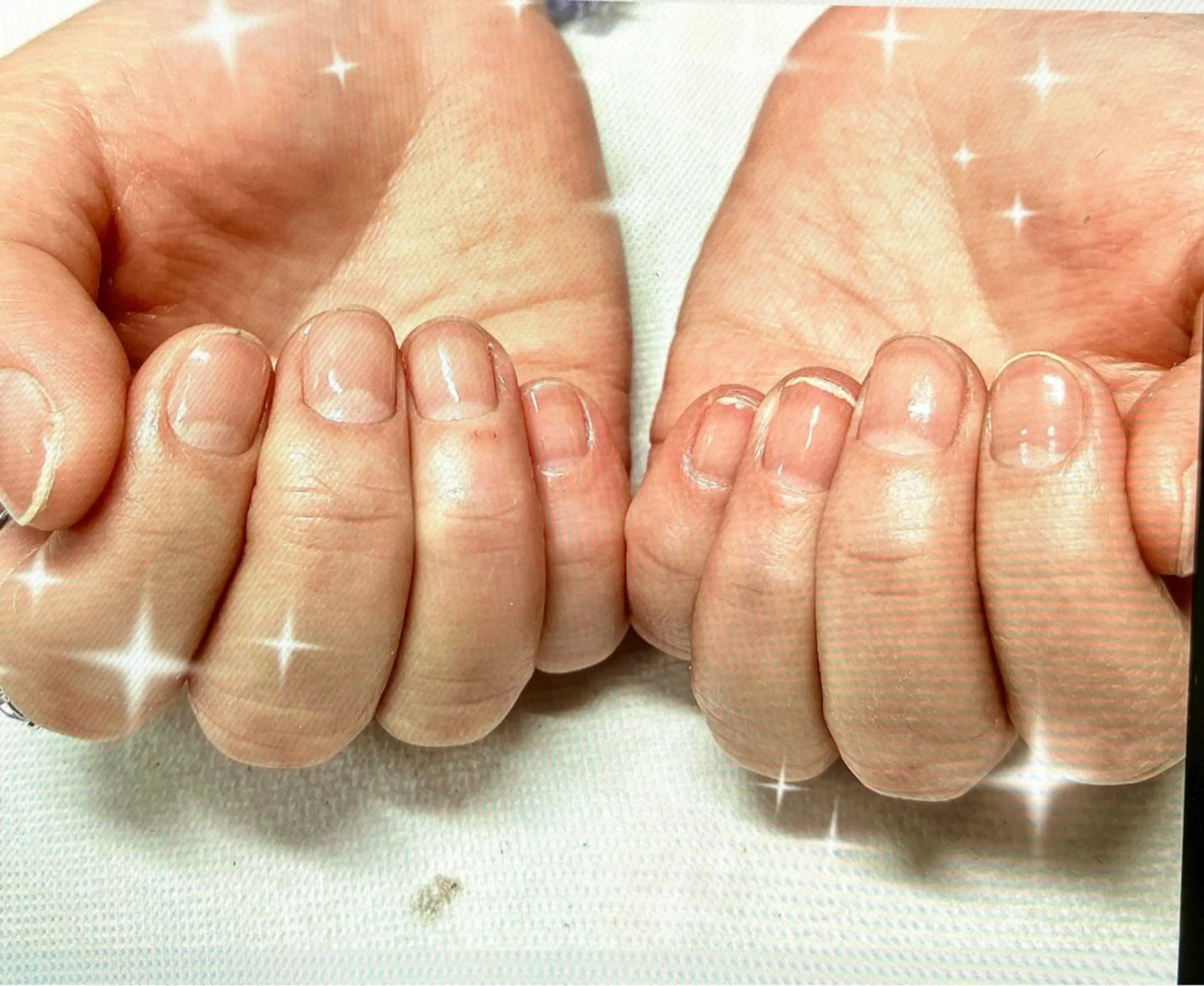 ネイルケア【磨き付き】の写真