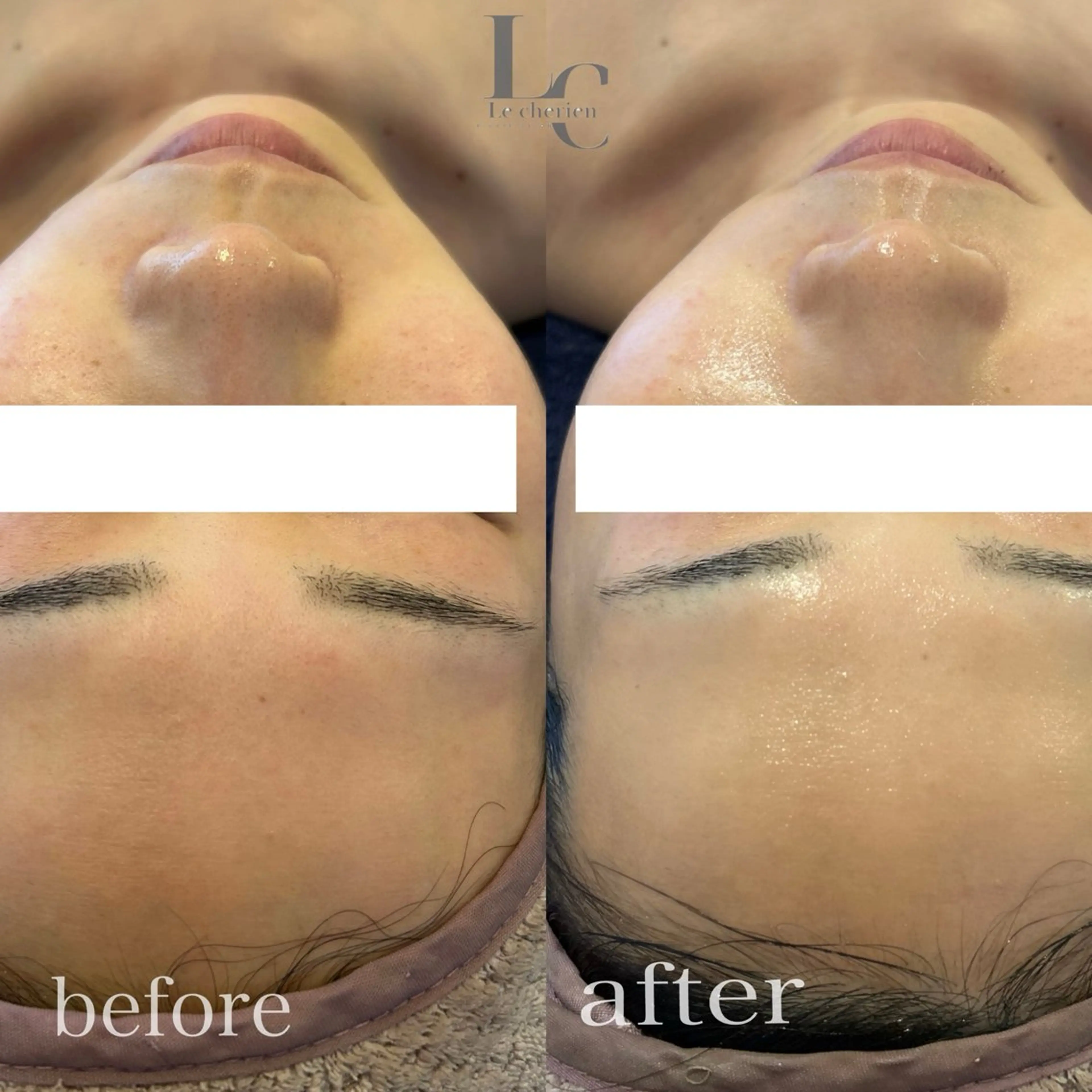 Le cherienのエステ・リラクイメージ