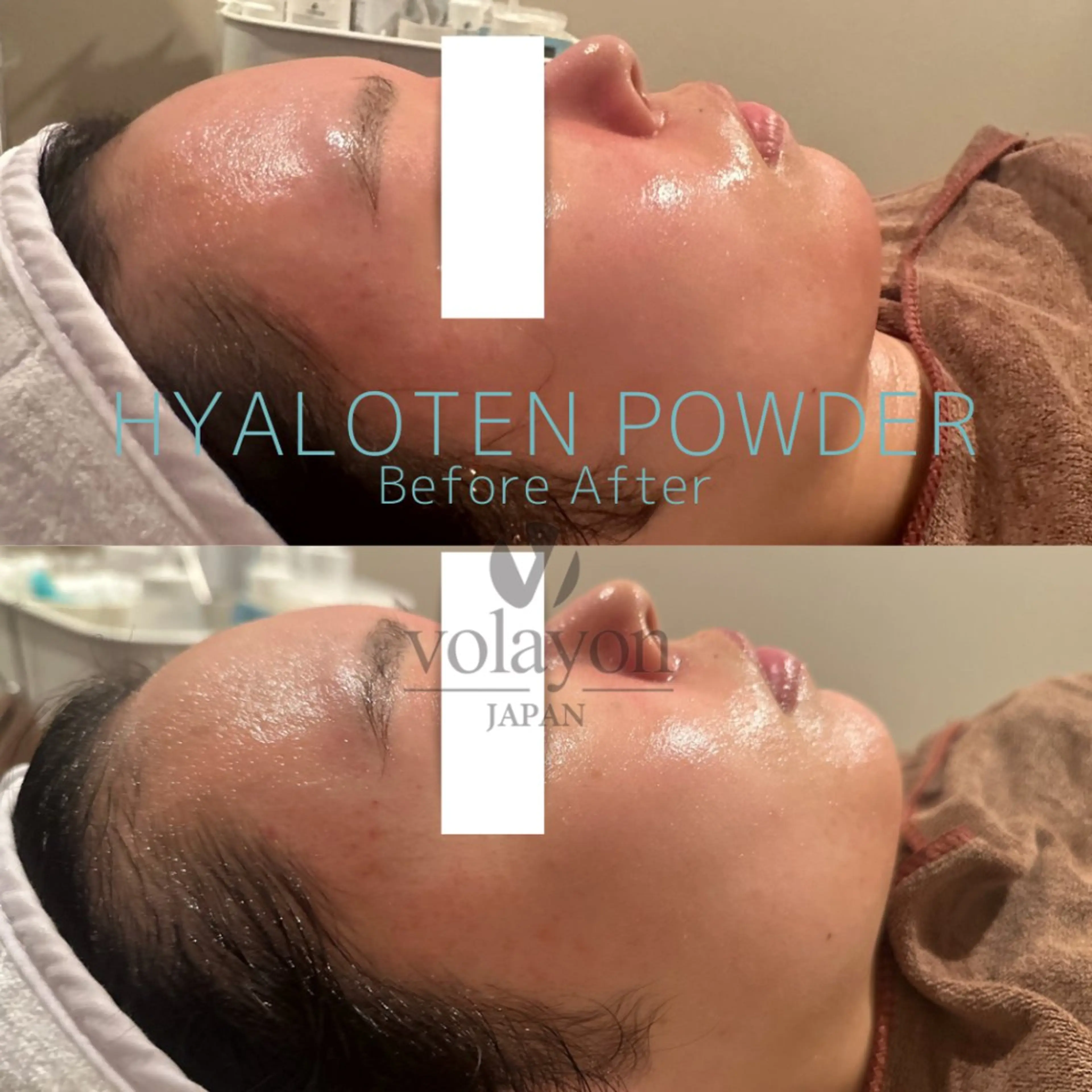 エステ リラク 【韓国肌管理・脱毛】 クレセントのその他イメージ