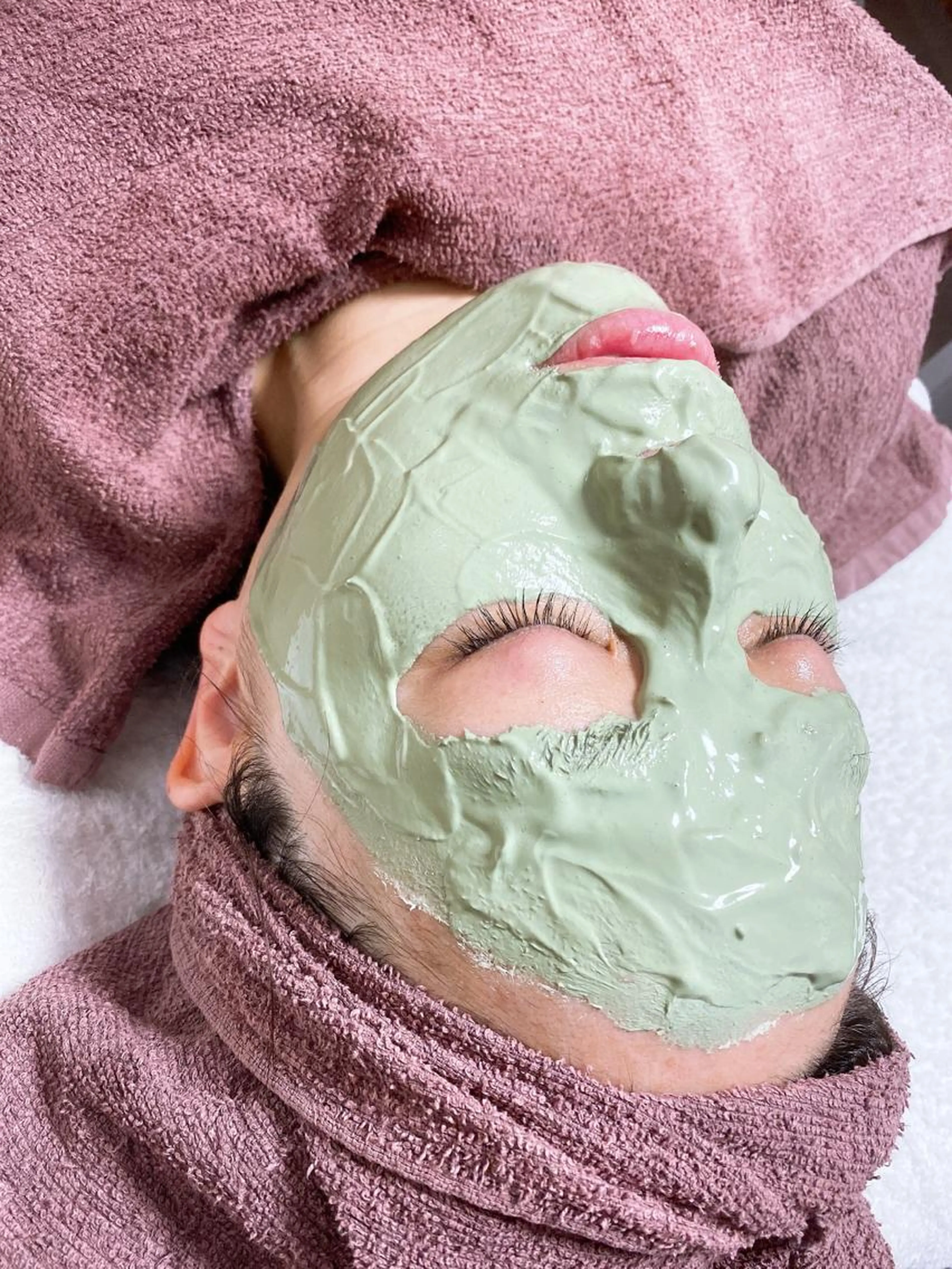 ニキビ皮脂専門エステ💆‍♀️吹出物ケア！ニキビ毛穴皮脂のケアが得意なサロンのスペシャルパック付きの写真