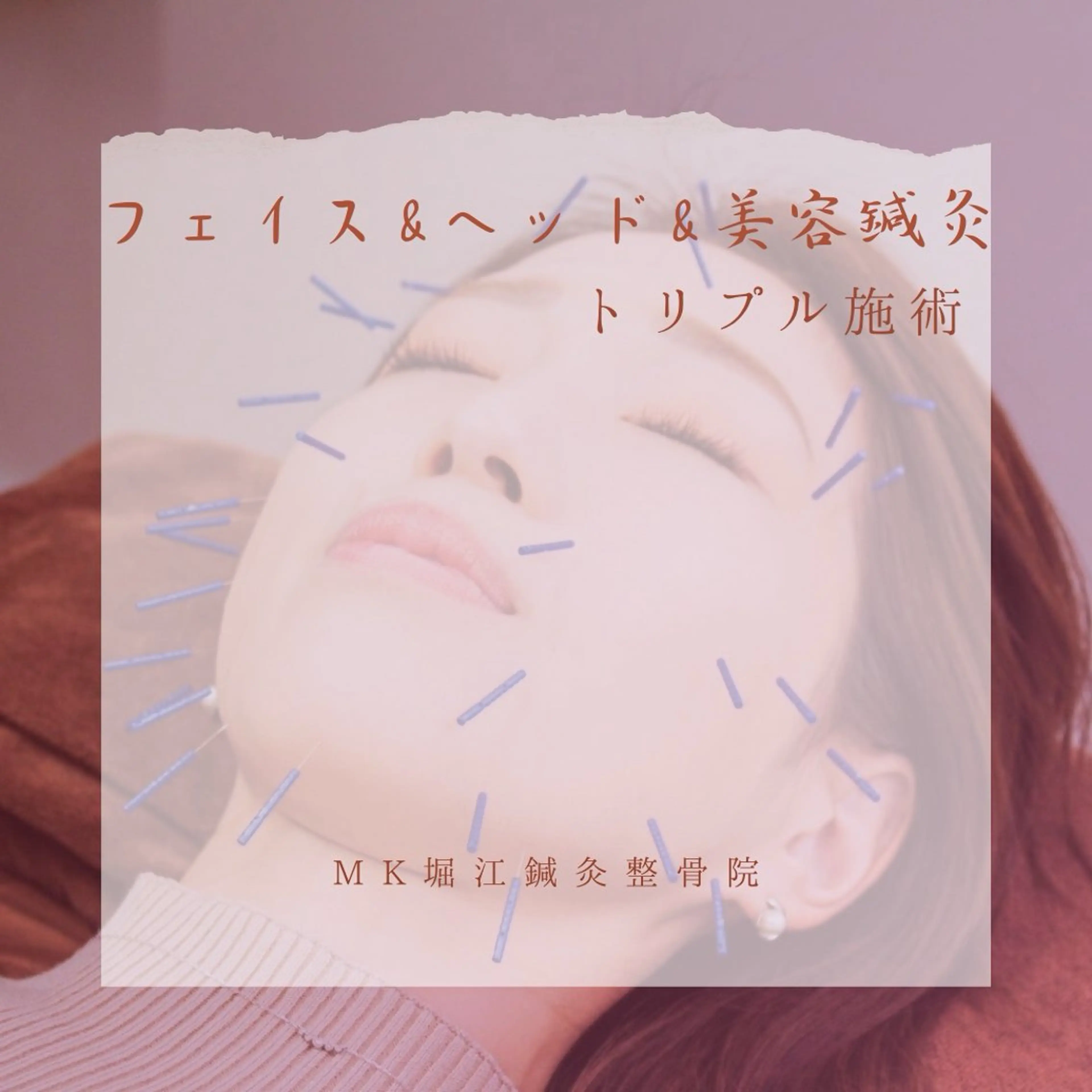小顔/美容鍼/整体 MITSUKIのその他イメージ