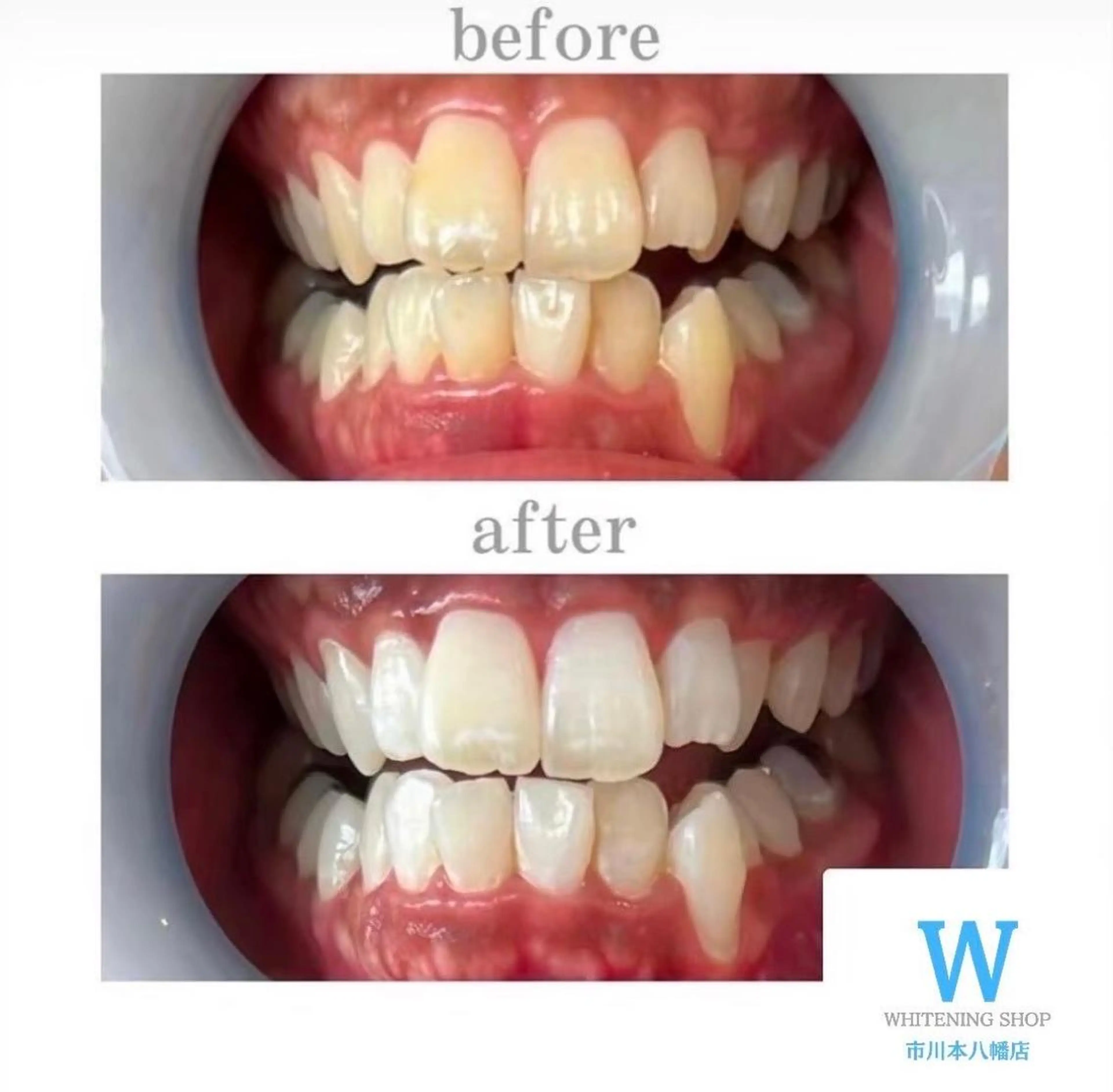 メンズ エステ リラク ホワイトニング ショップ本八幡店のエステ・リラクイメージ