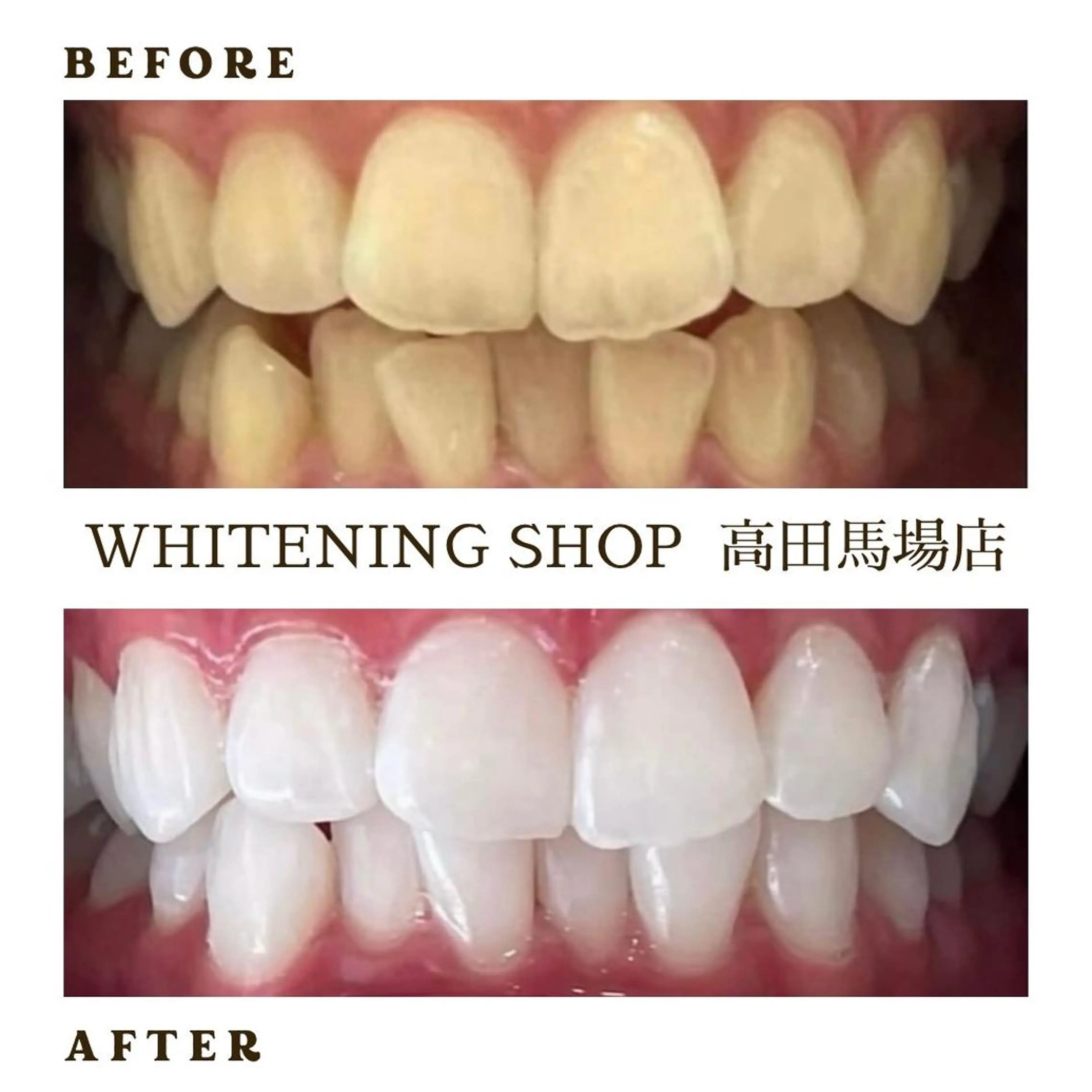 メンズ その他 ホワイトニング ショップ高田馬場店のその他イメージ
