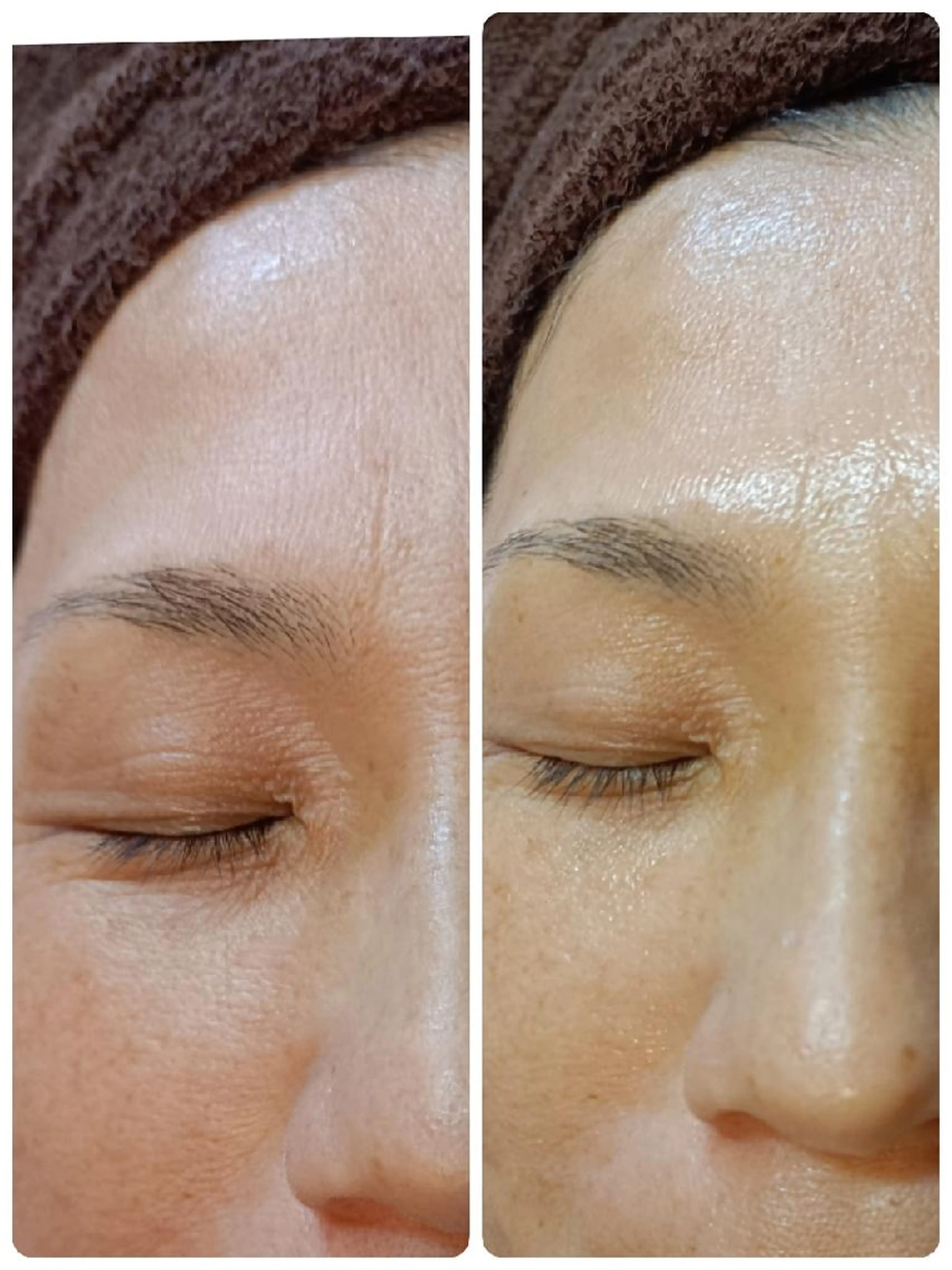 【女性限定】毛穴つるん・透明感UP・小顔印象へ！肌リズムケア&むくみ流し付き(70分)の写真