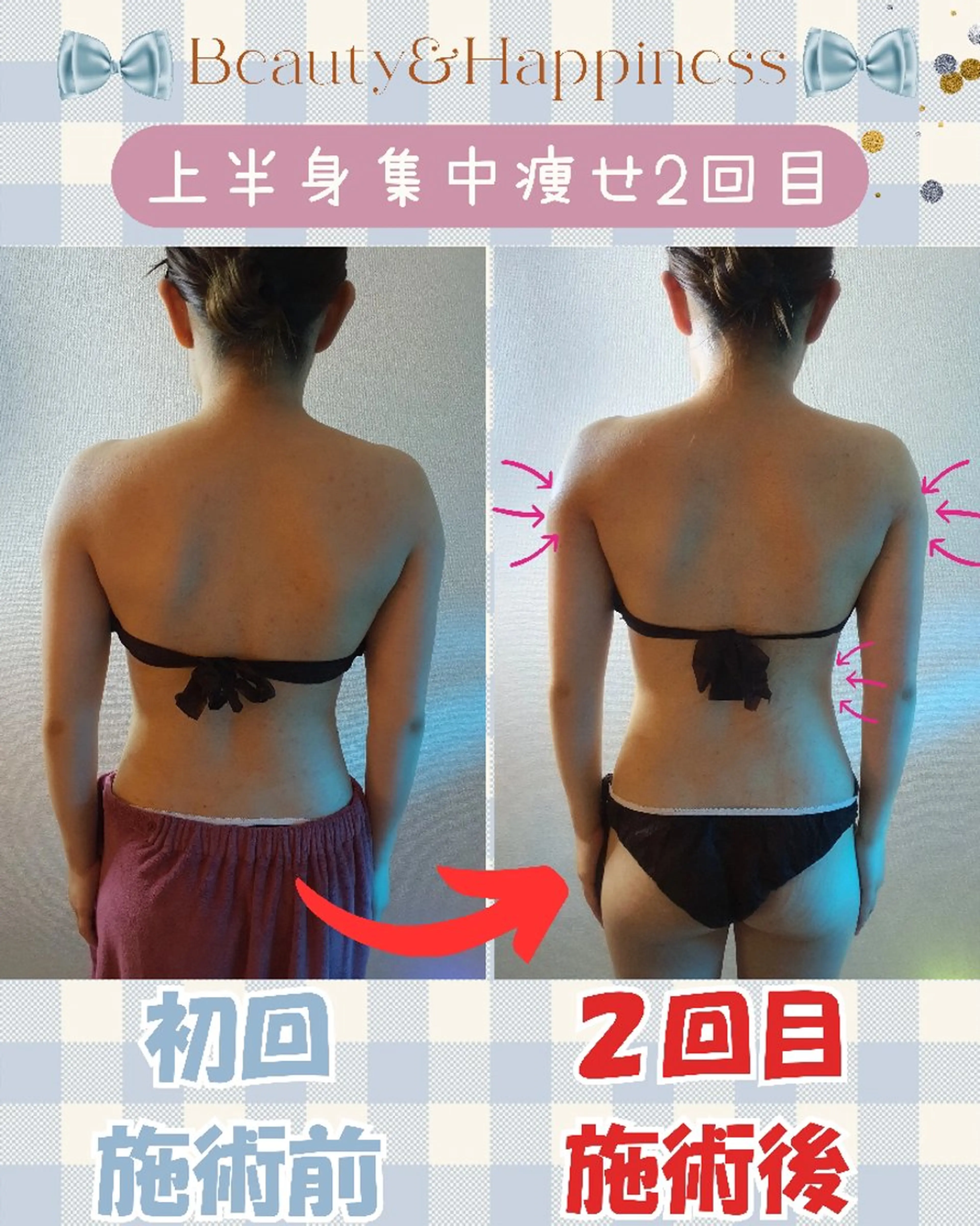 痩身ハーブピーリング 筋膜リリース☆B&Hのエステ・リラクイメージ