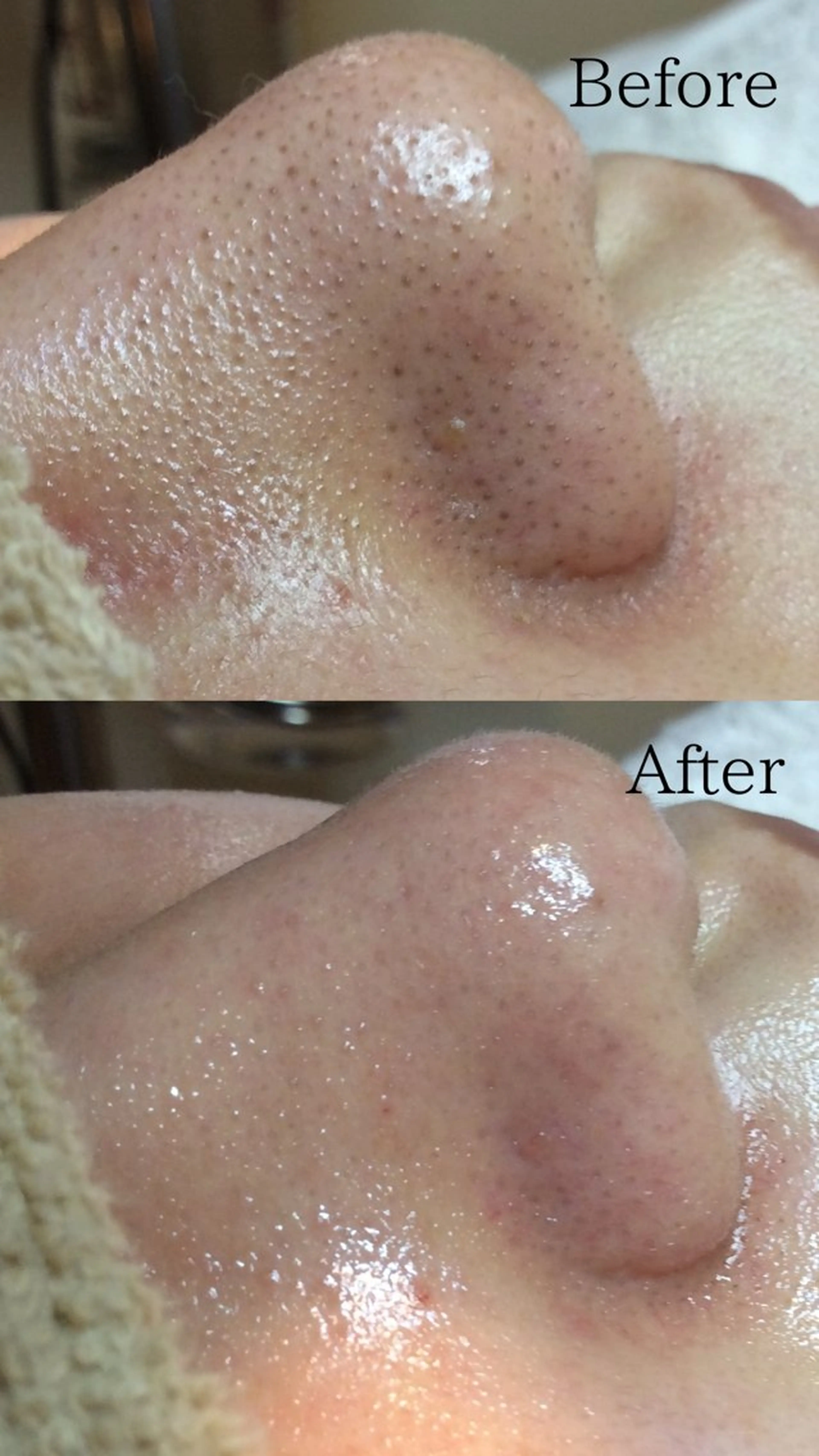 エステ エステサロン　Lazulisea所属・川口 春奈のエステ・リラクイメージ