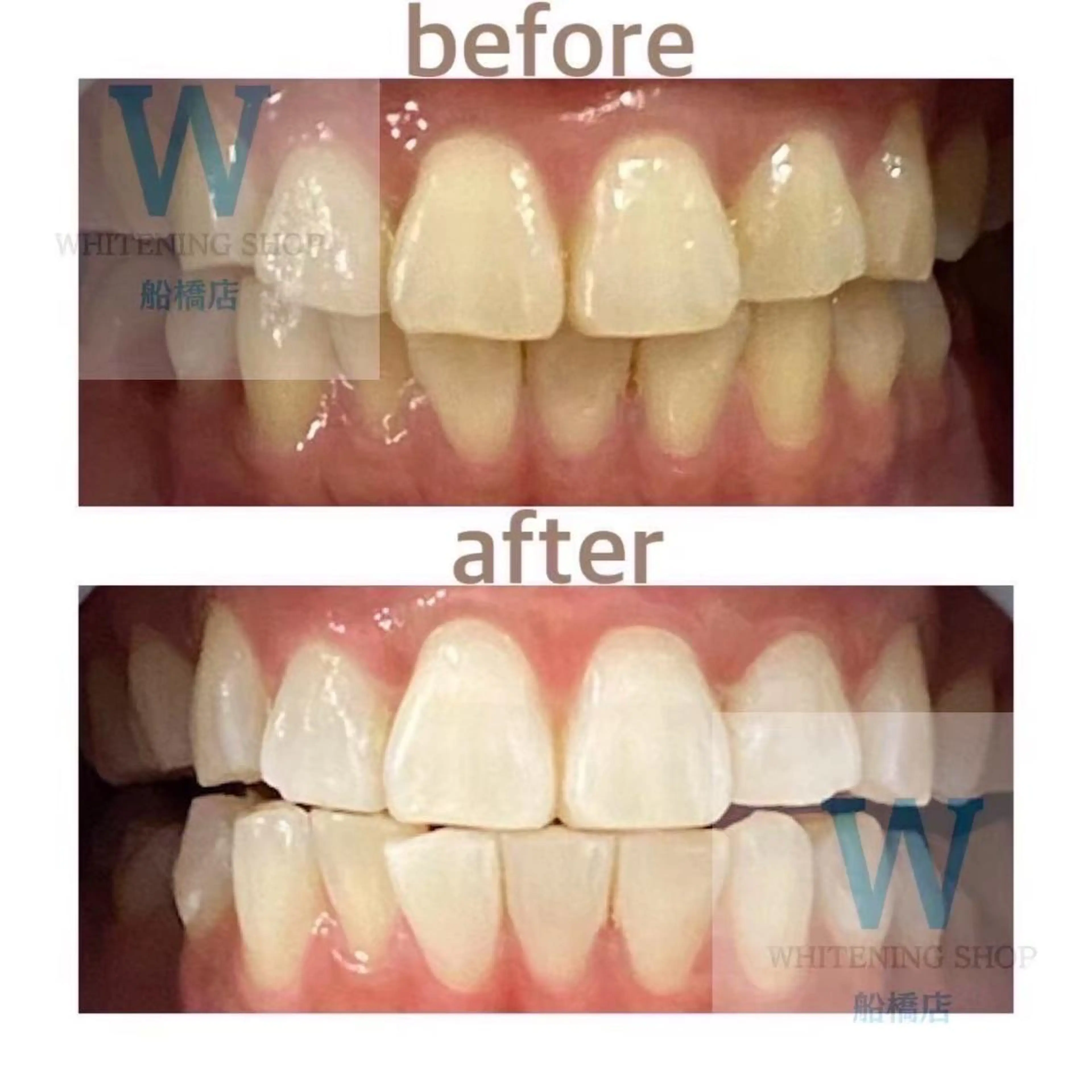 ホワイトニング ショップ船橋店🦷のエステ・リラクイメージ