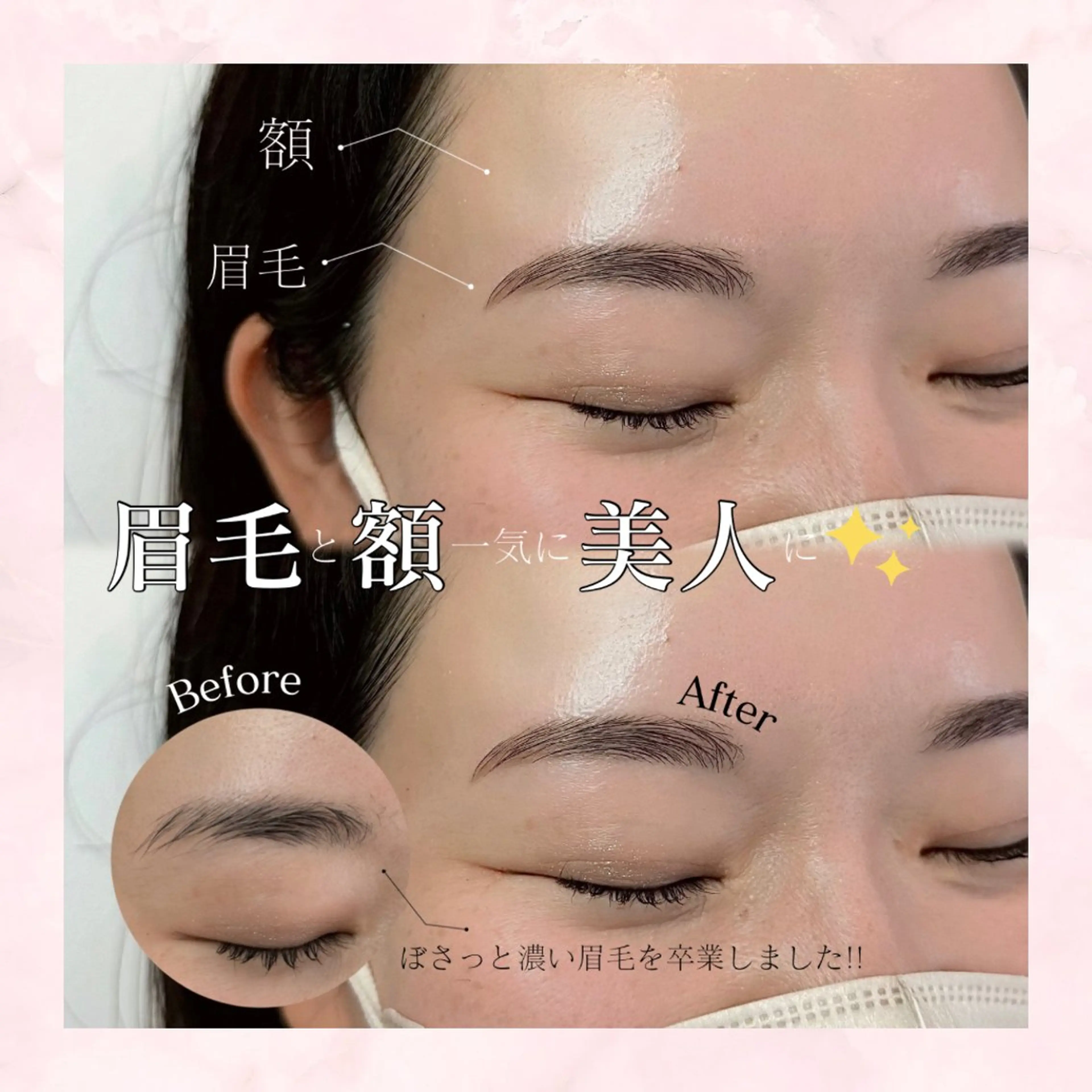 アイブロウ Lea堺東　毛穴洗浄 ×顔ワックス脱毛のその他イメージ