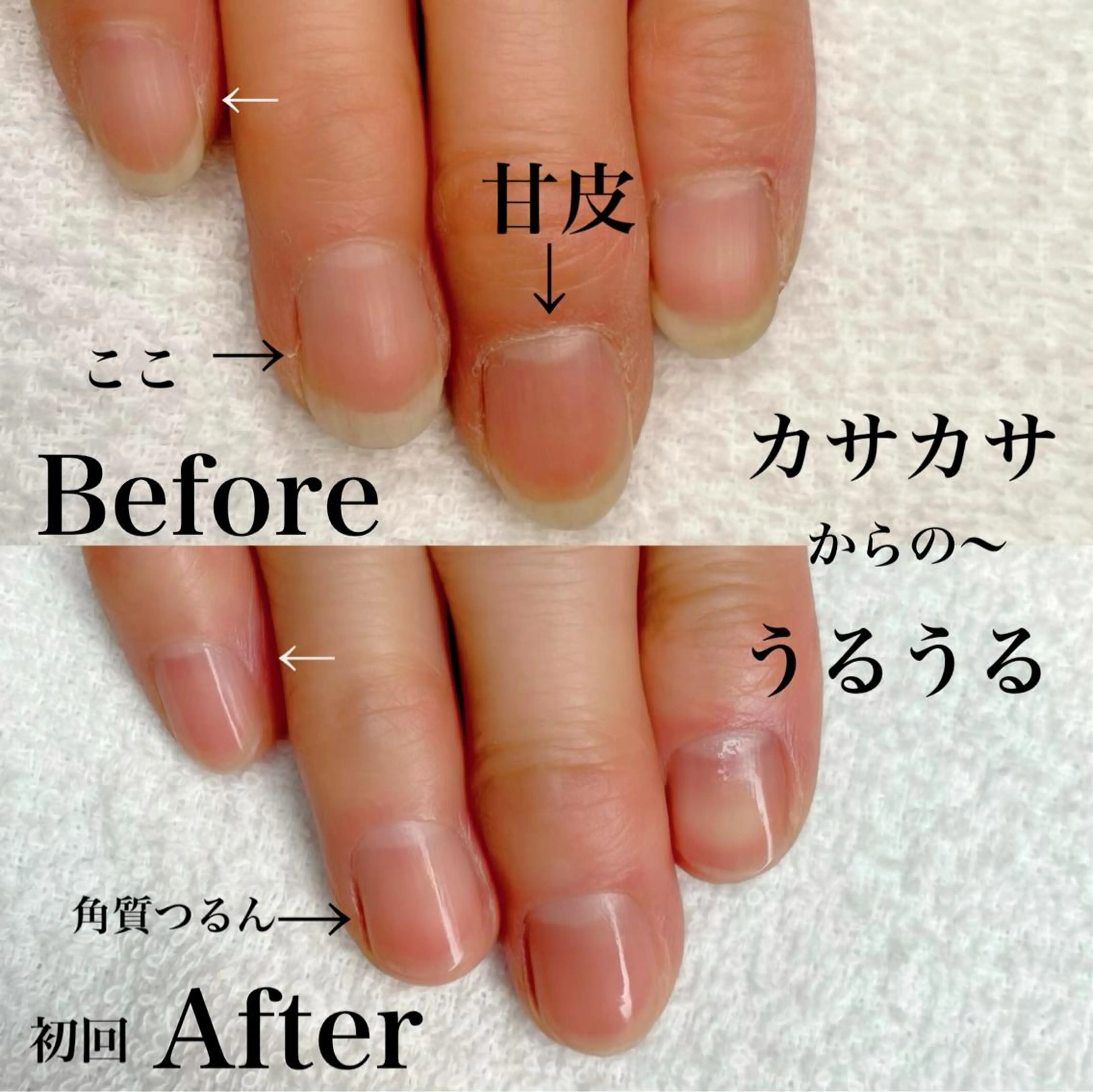 ネイル 氷ネイル・うるうるネイル 森崎 麗のマツエク・マツパデザイン