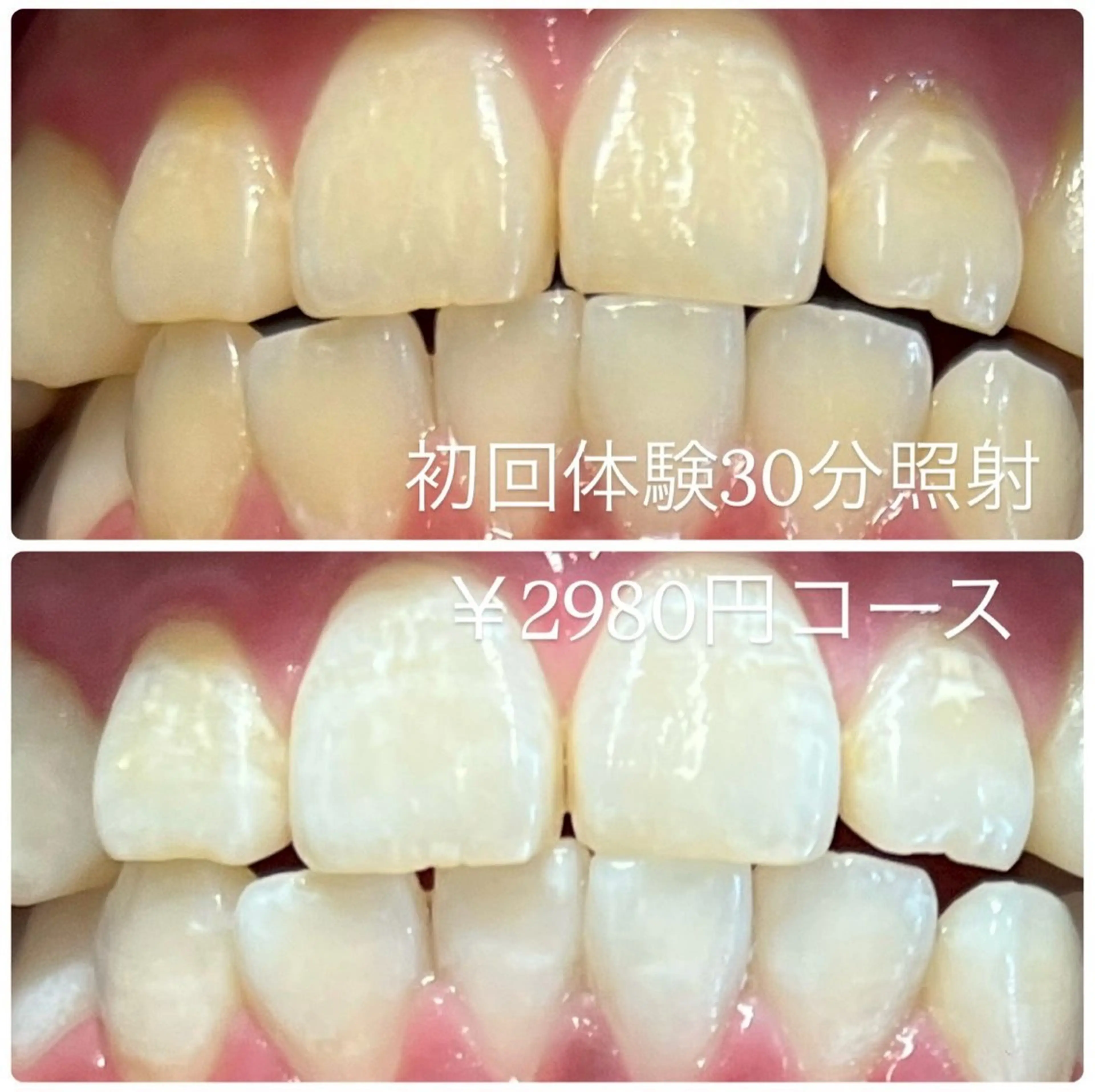 メンズ その他 ホワイトニング ルーム　川崎店のその他イメージ