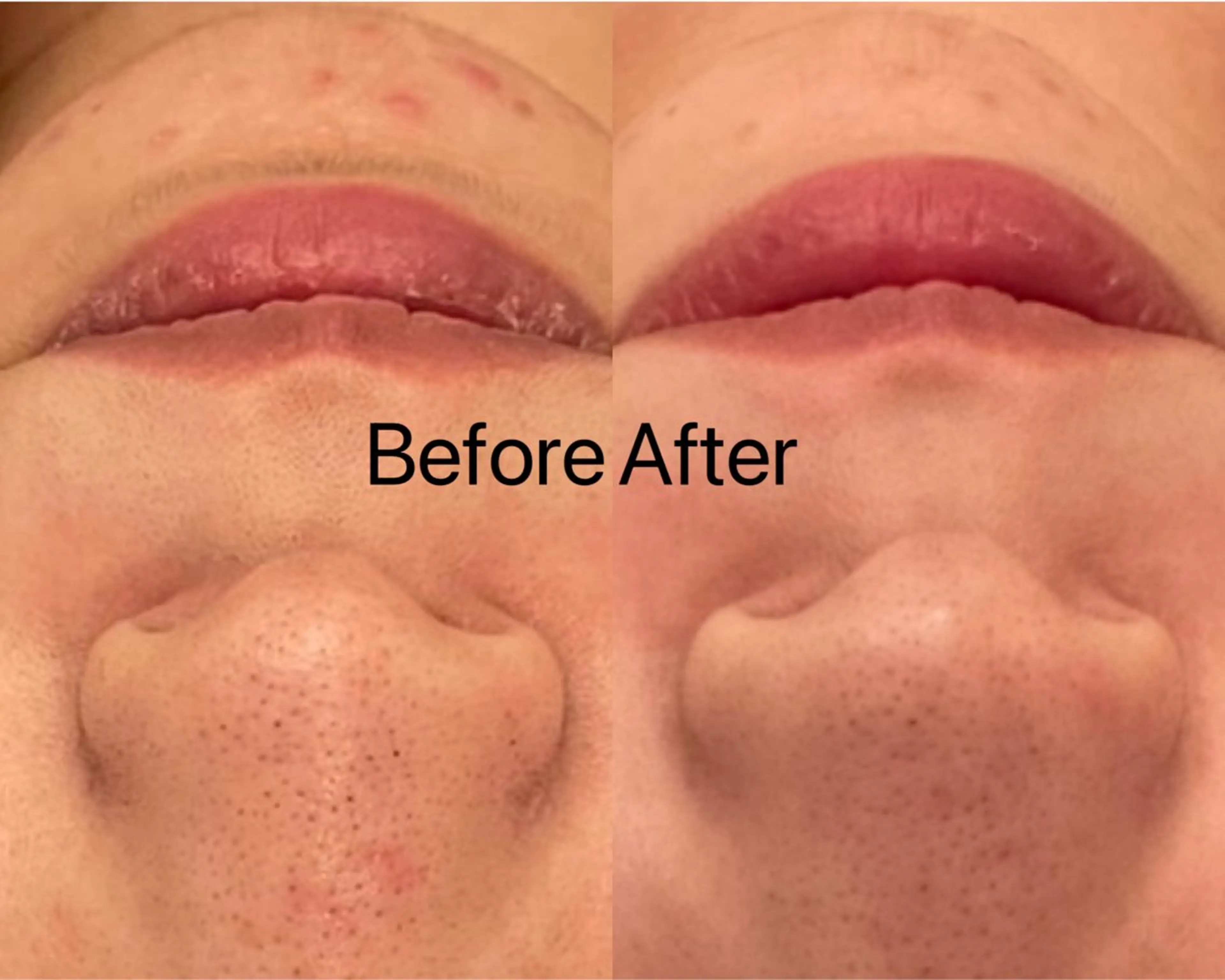 エステ Ginza Charerのエステ・リラクイメージ