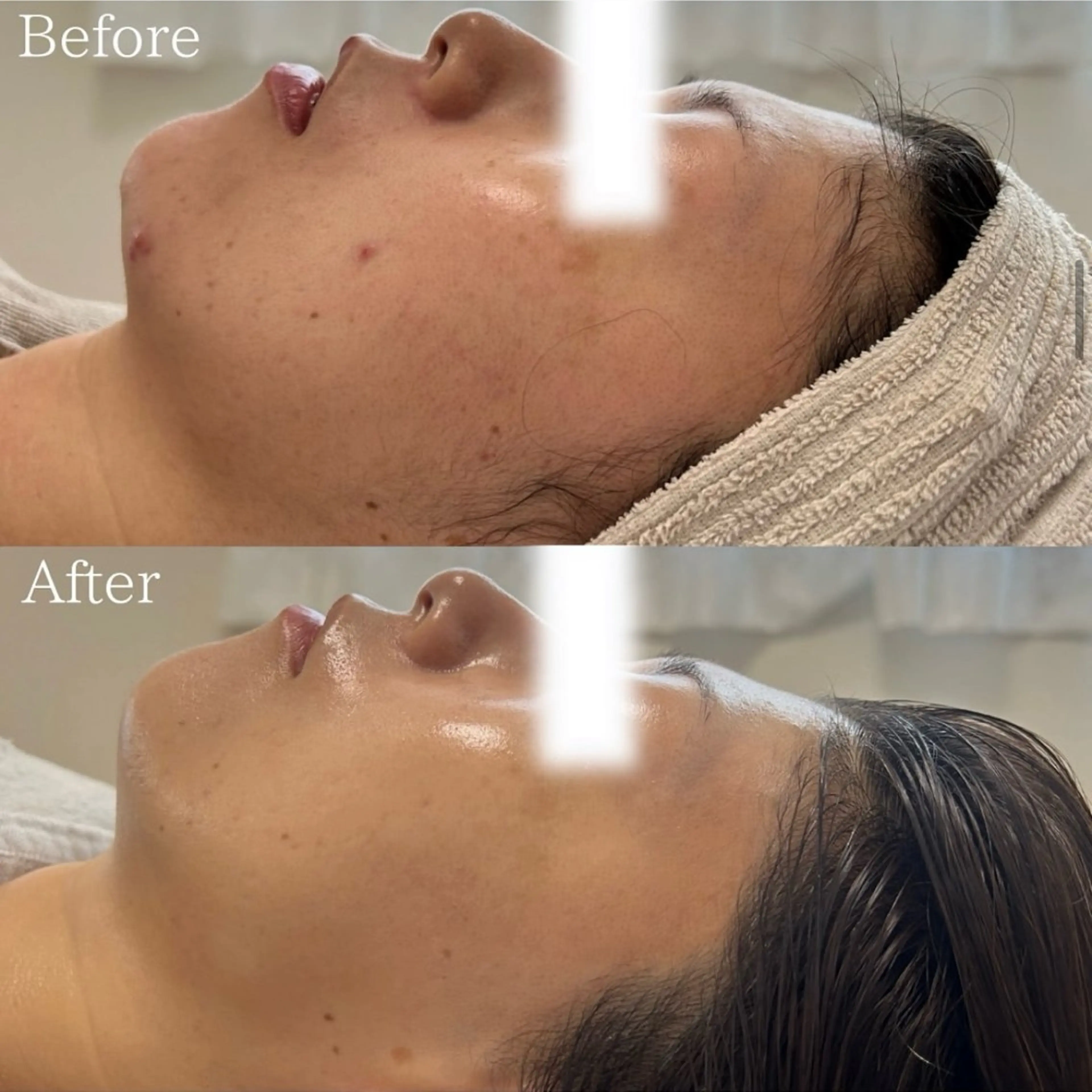 silo 結果重視の美肌サロンのエステ・リラクイメージ