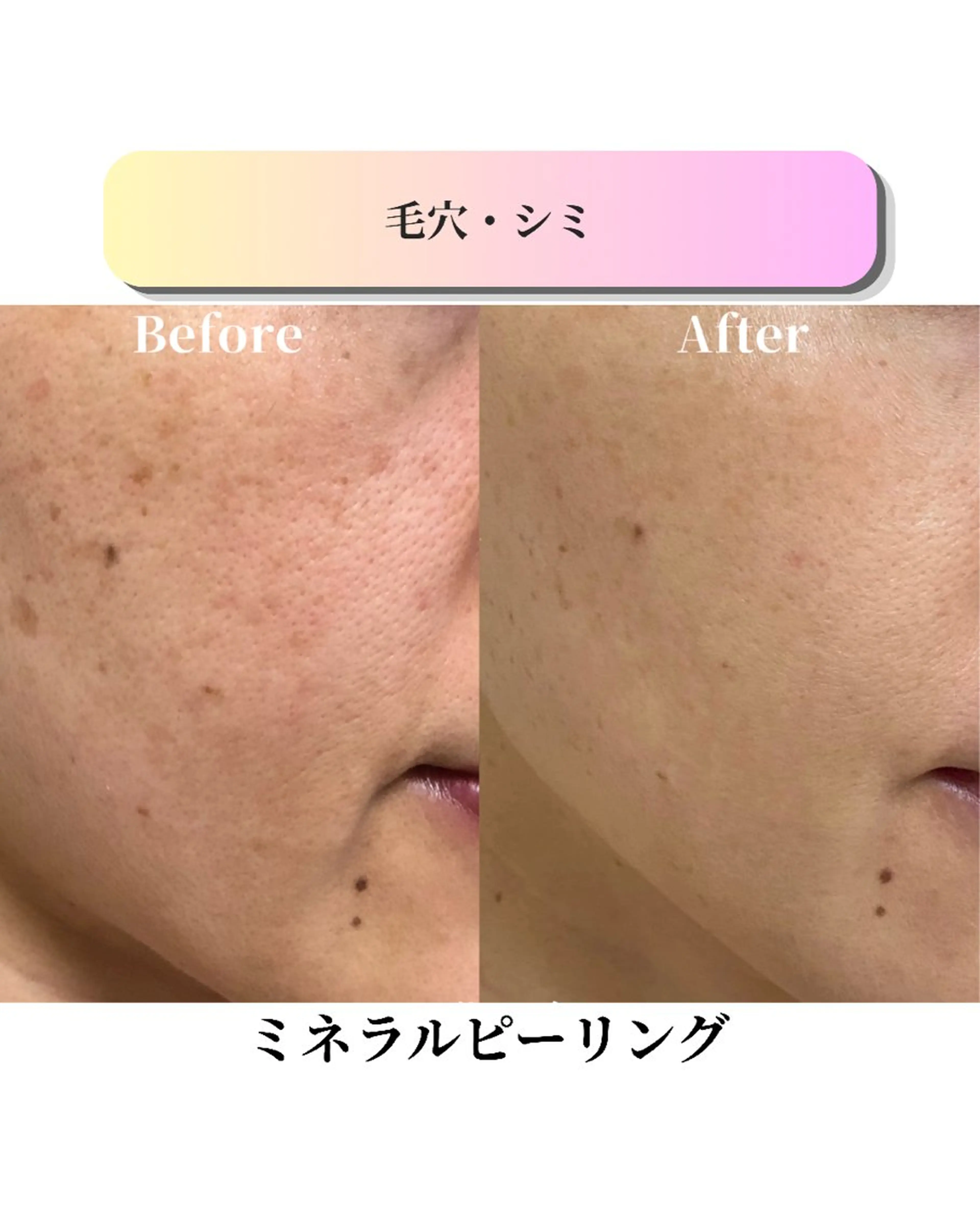 エステ ローズフィールド 森岡朋美のエステ・リラクイメージ