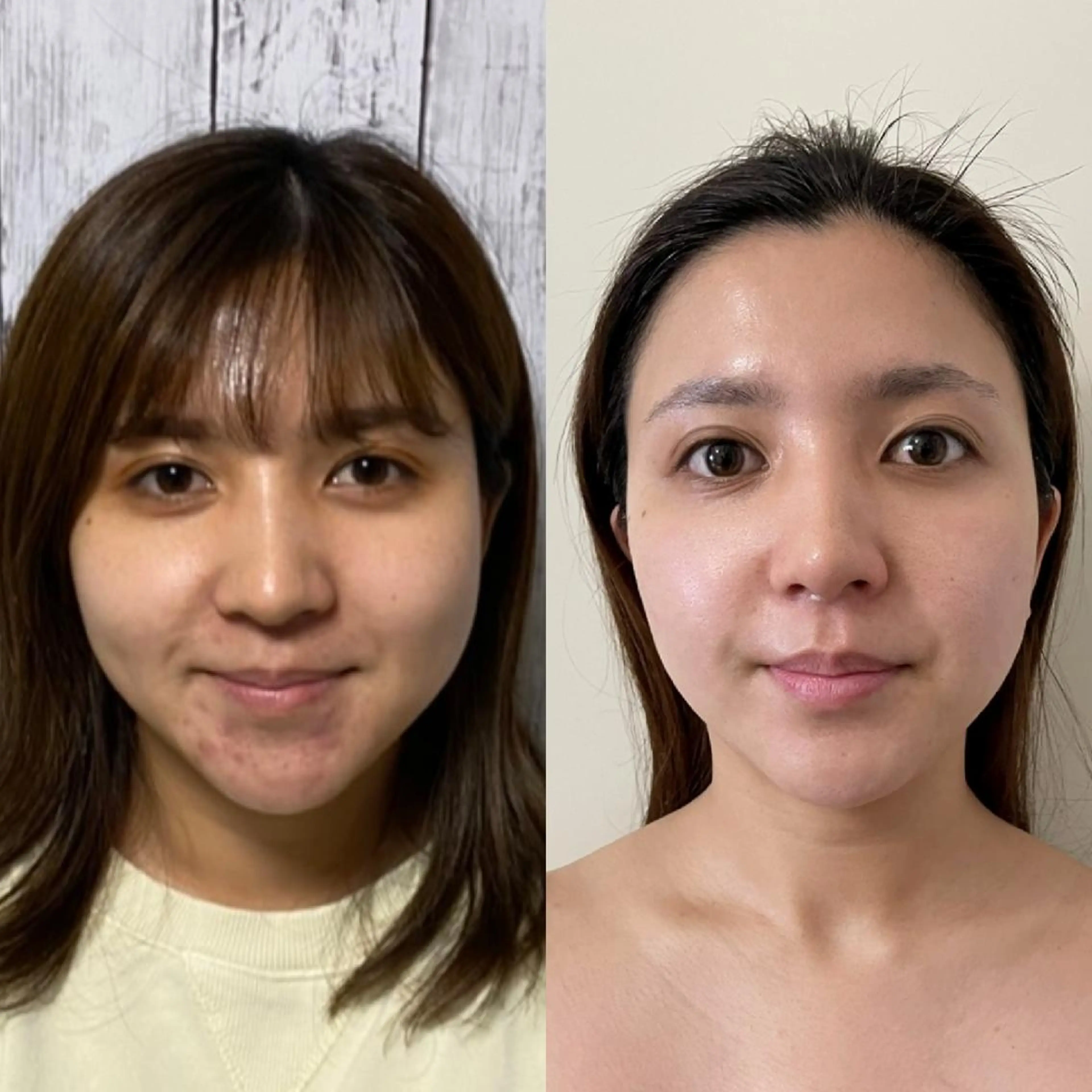 小顔美肌エステサロン パステル・岡本直子のエステ・リラクイメージ