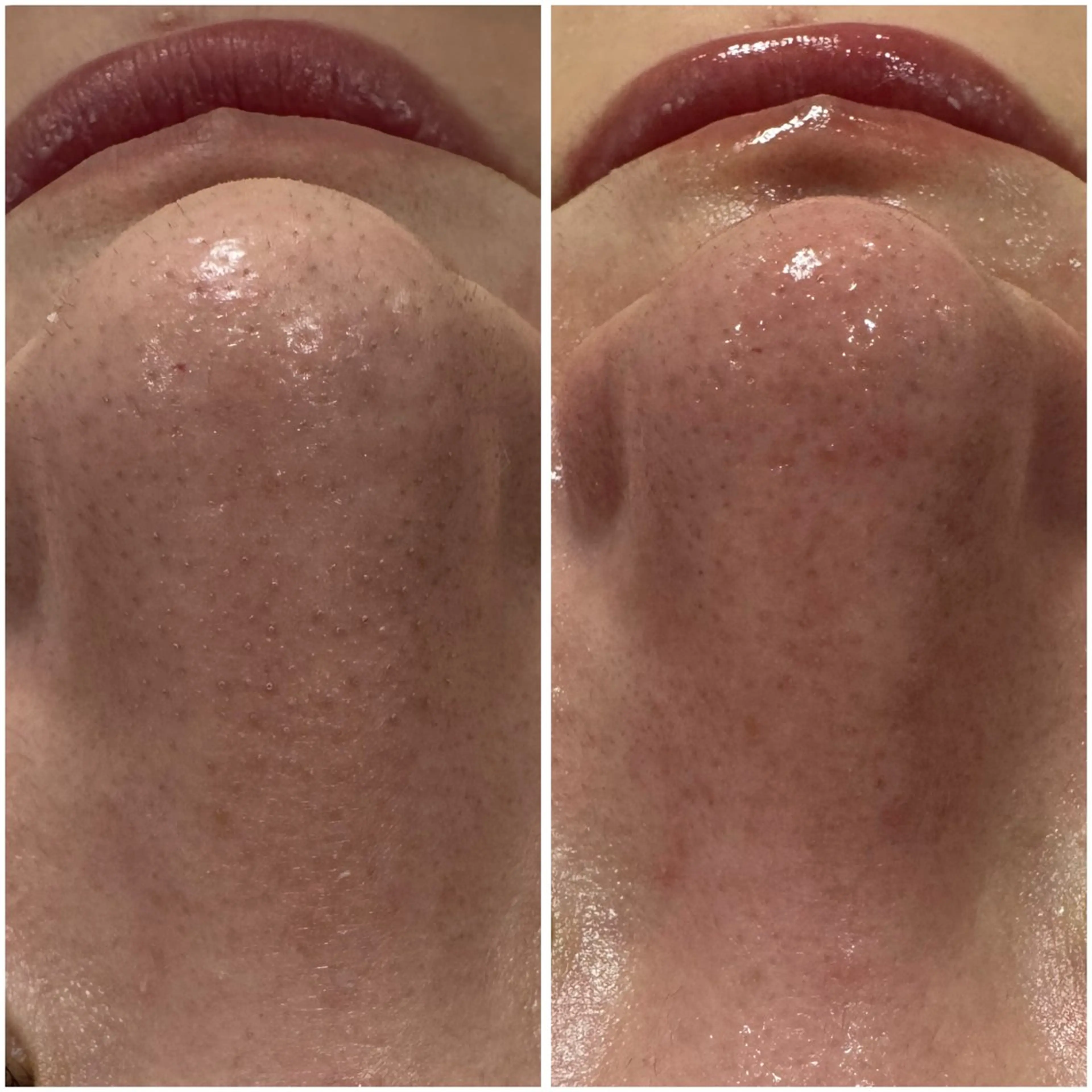 肌質改善サロン Manaririoのエステ・リラクイメージ